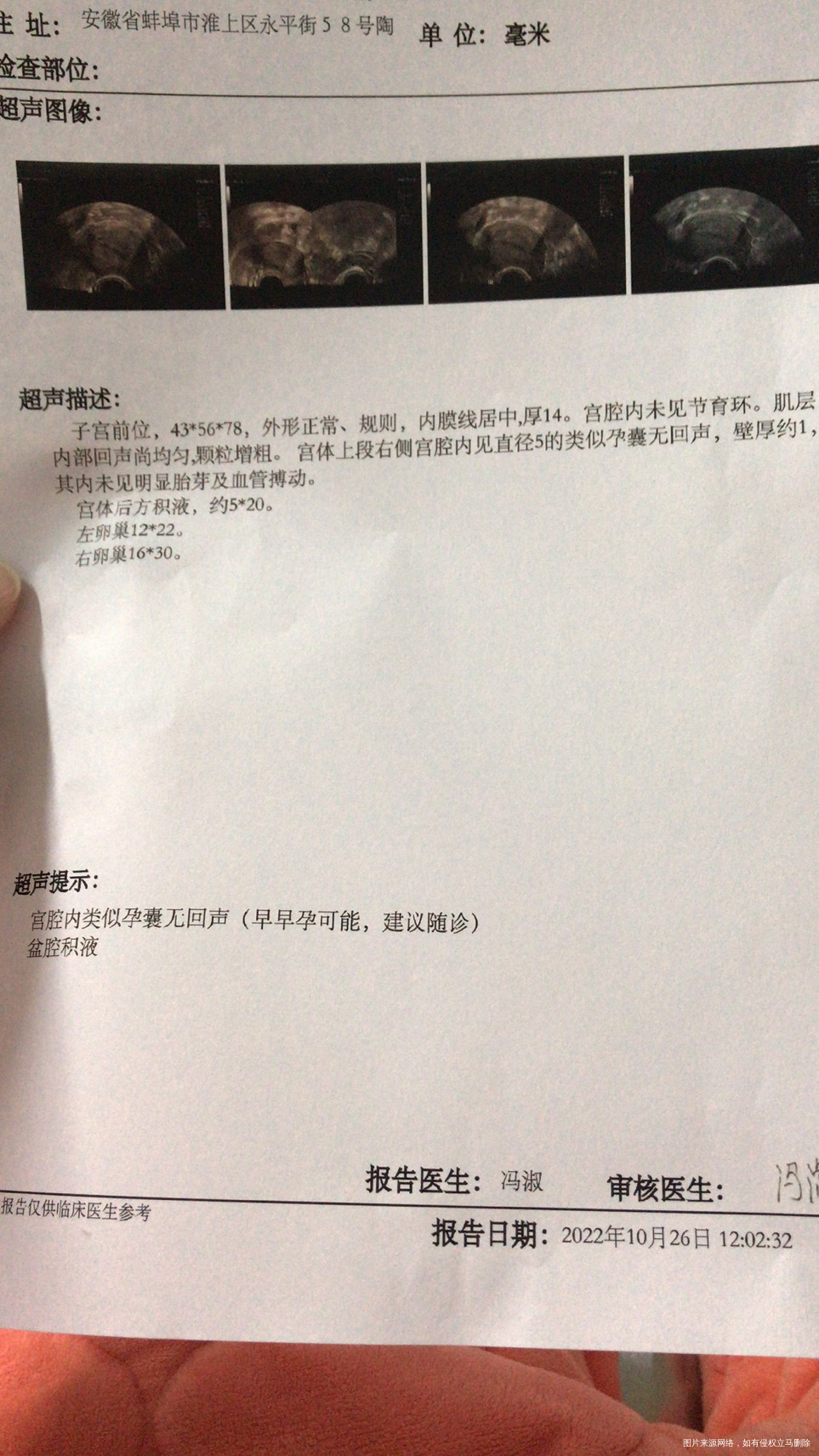 末次月经9月231021HCG1361024