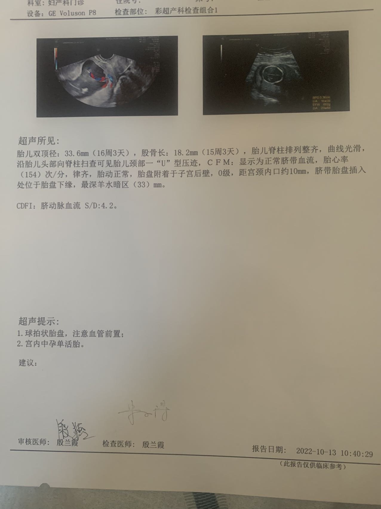 今天我去医院做了b超查了下宫颈管长度还做了个