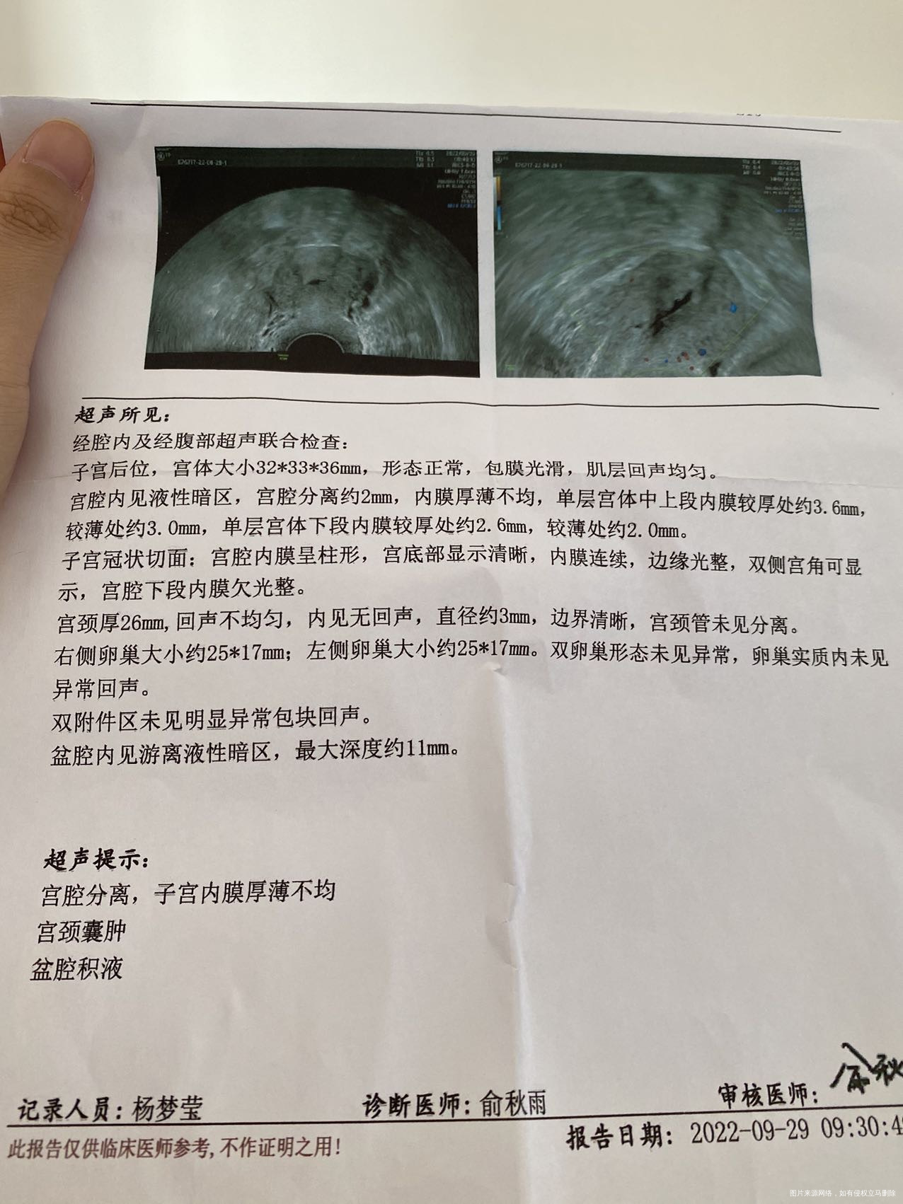 你好我是准备下个月移植冻胚的请问这个检查单有