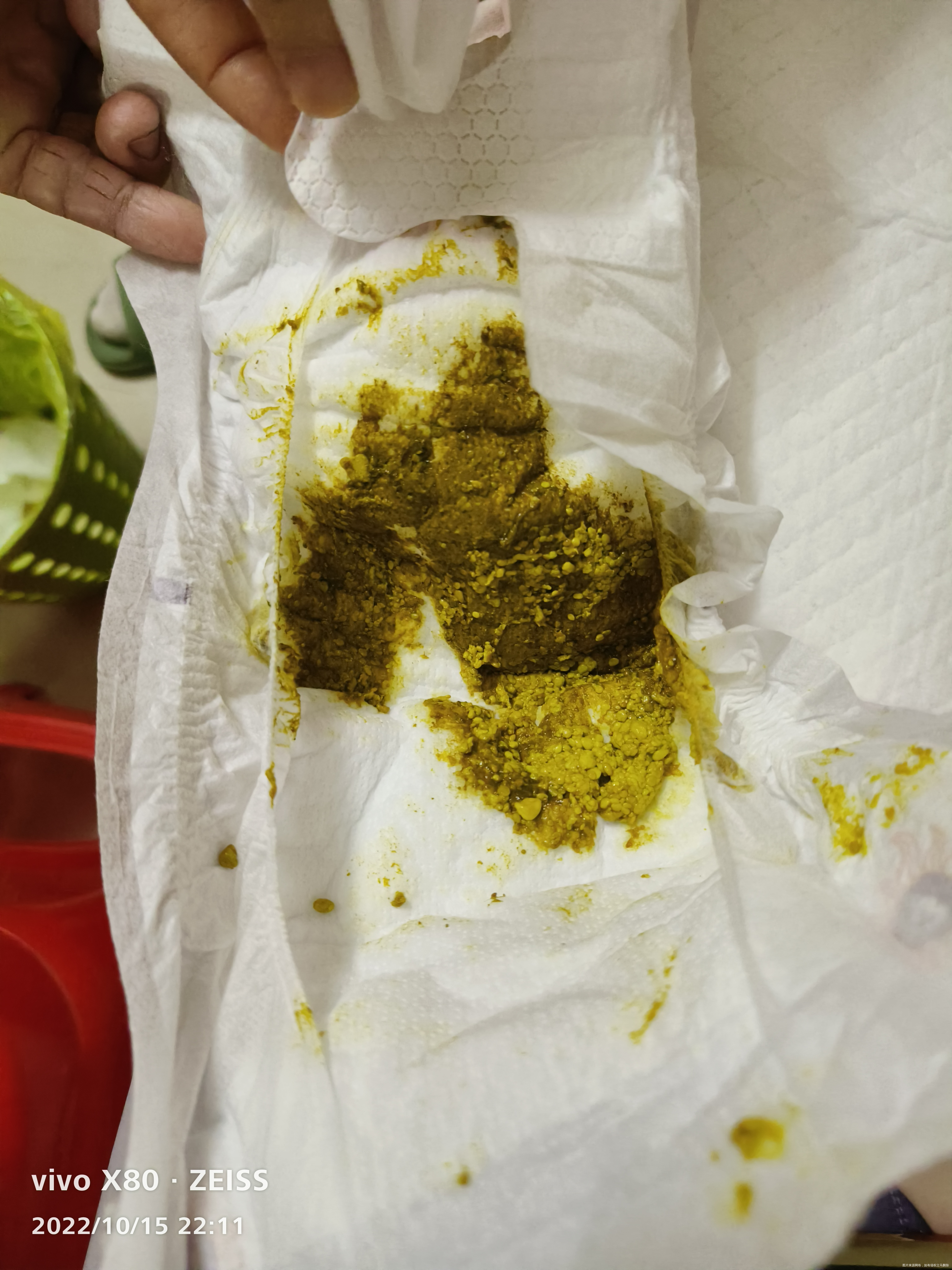 新生儿刚生第三天刚拉完胎粪拉的💩有异常吗黄