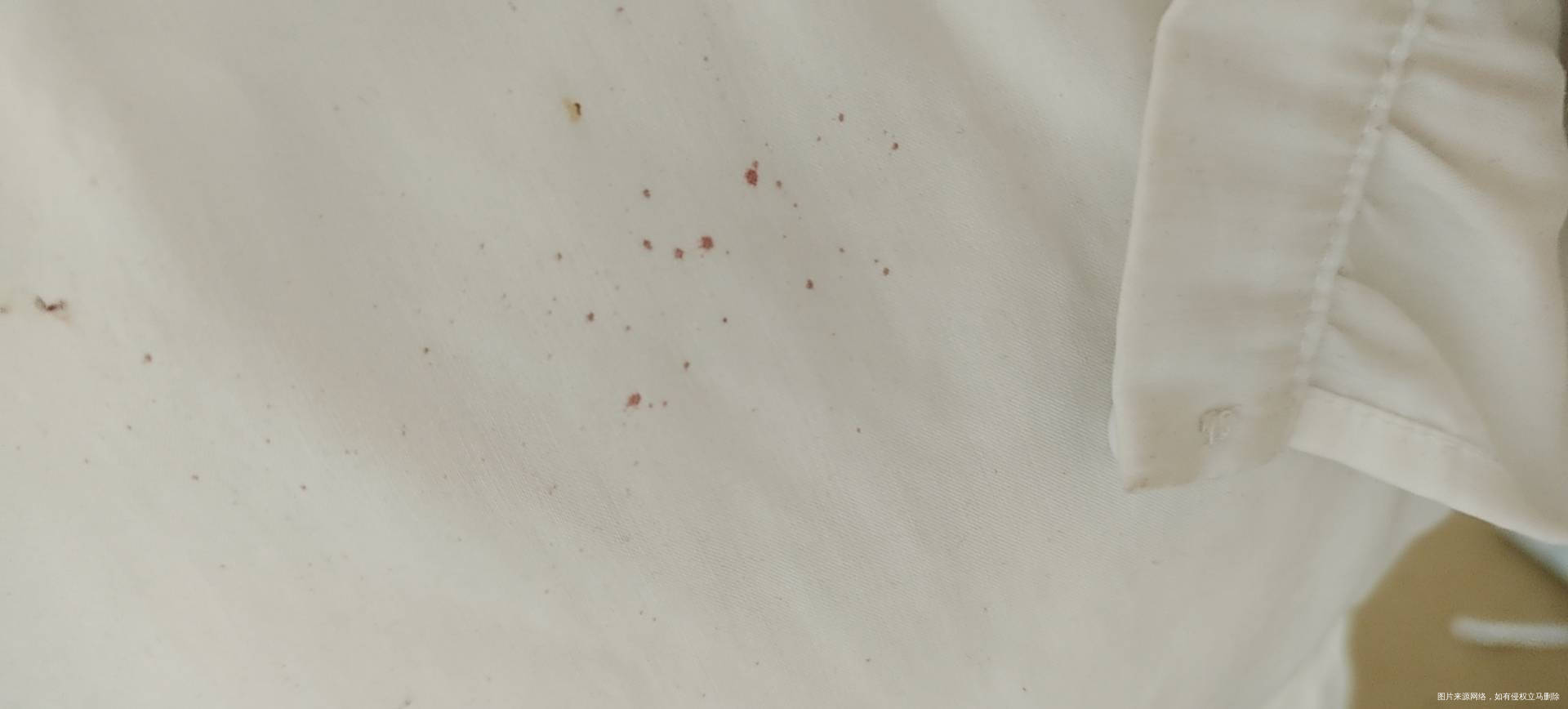 17周打喷嚏喷出血了是怎么回事而且感觉最近又