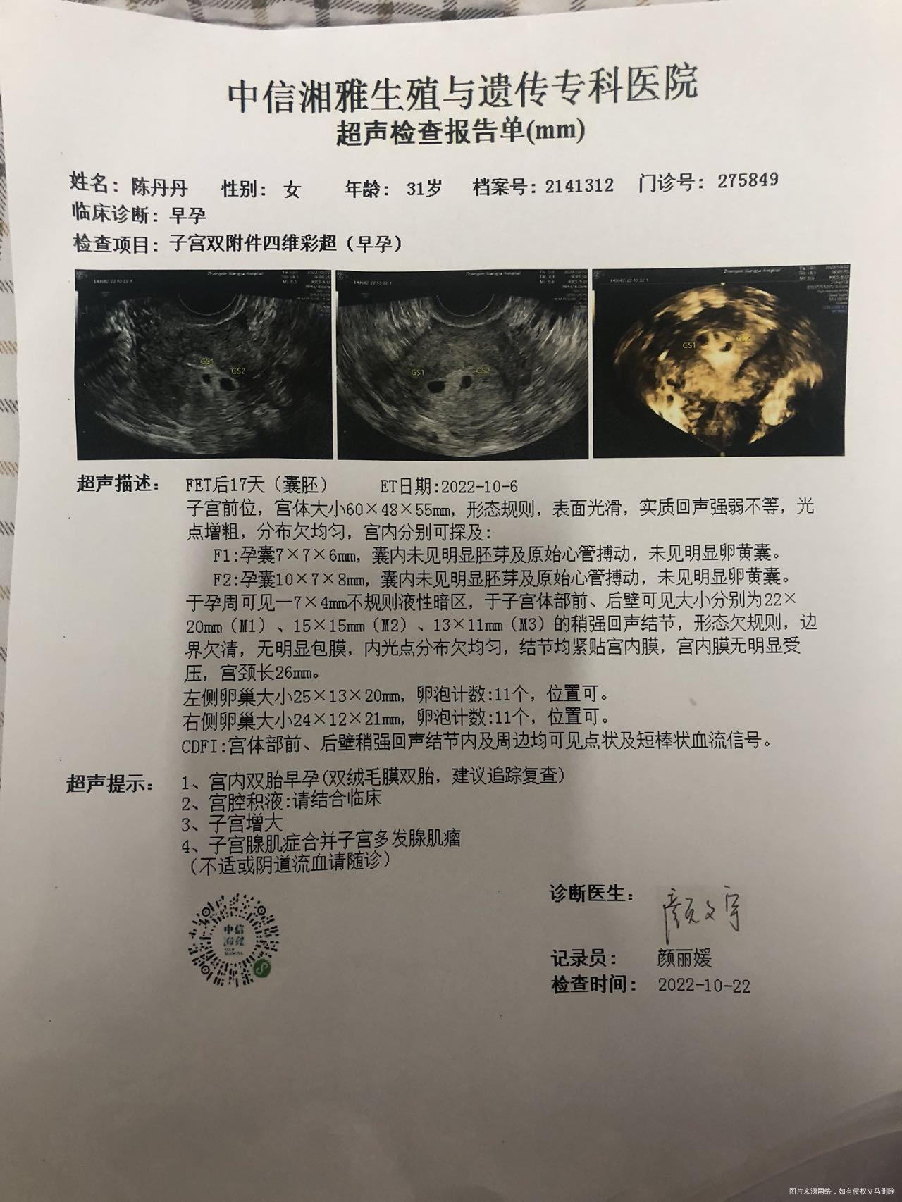 今天是移植冻囊胚的第十九天老是断断续续的见红