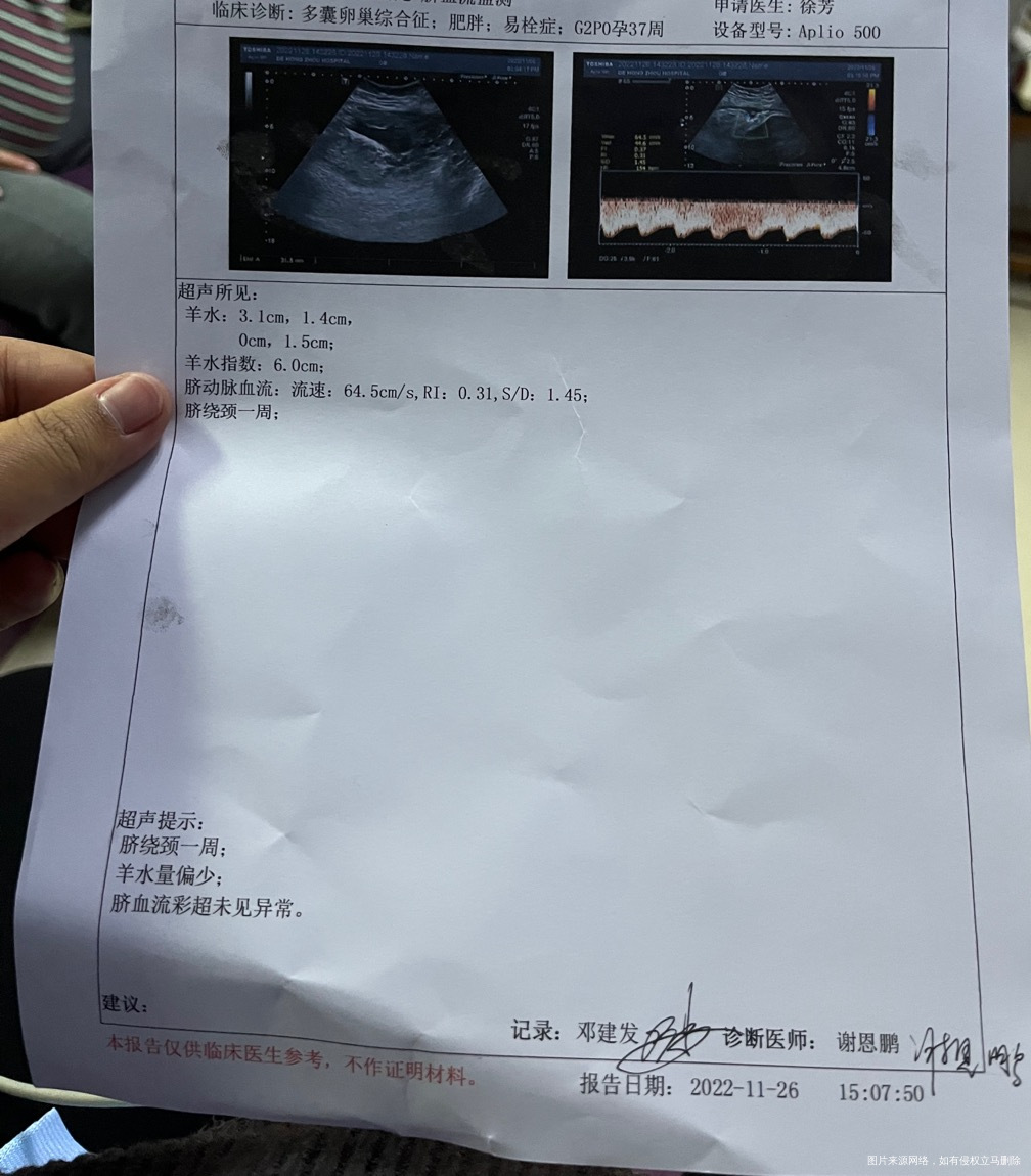 11月23号做b超羊水指数811月26做羊水