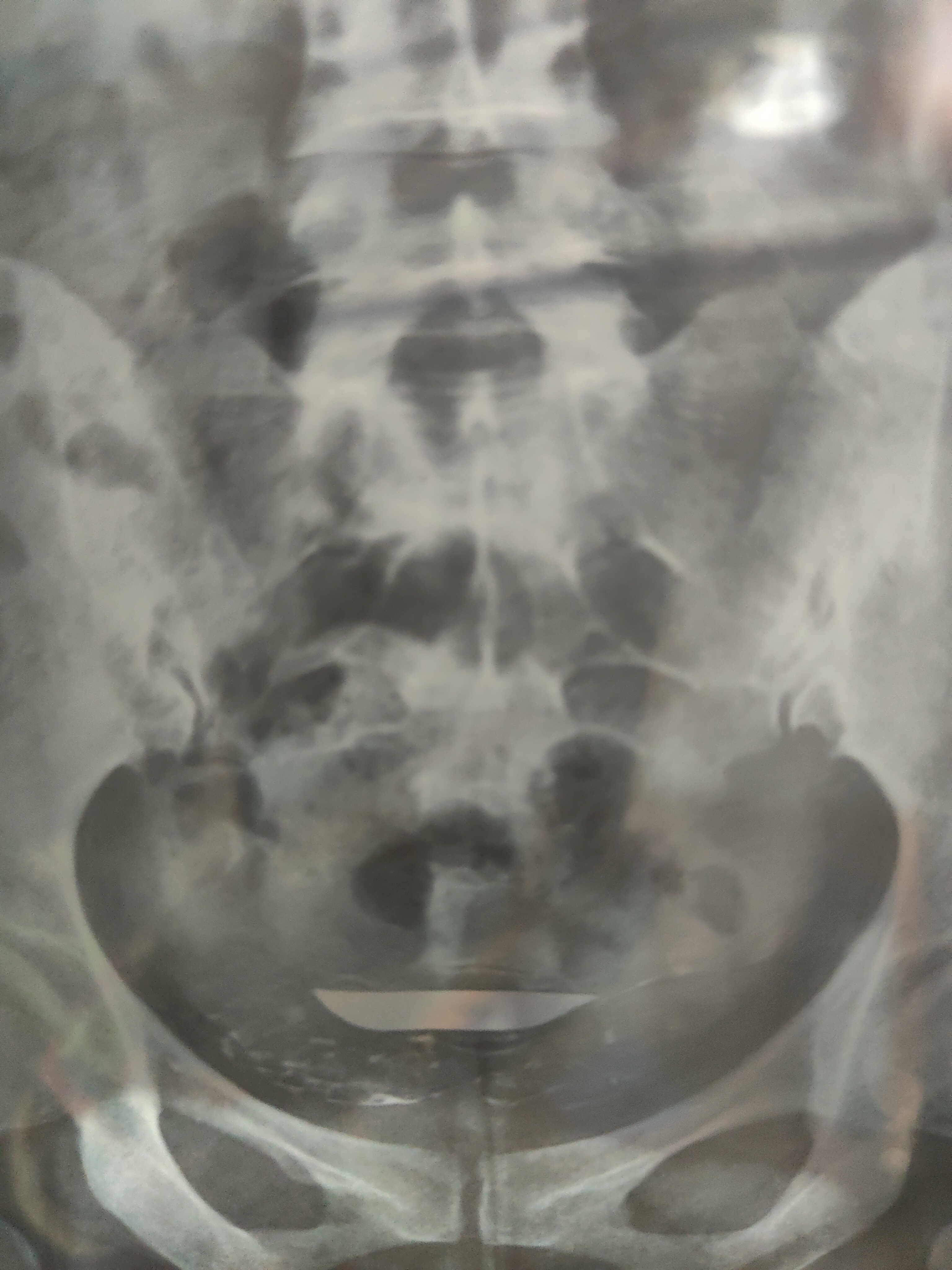 各位医生好前天做了输卵管造影请帮忙看看这些造