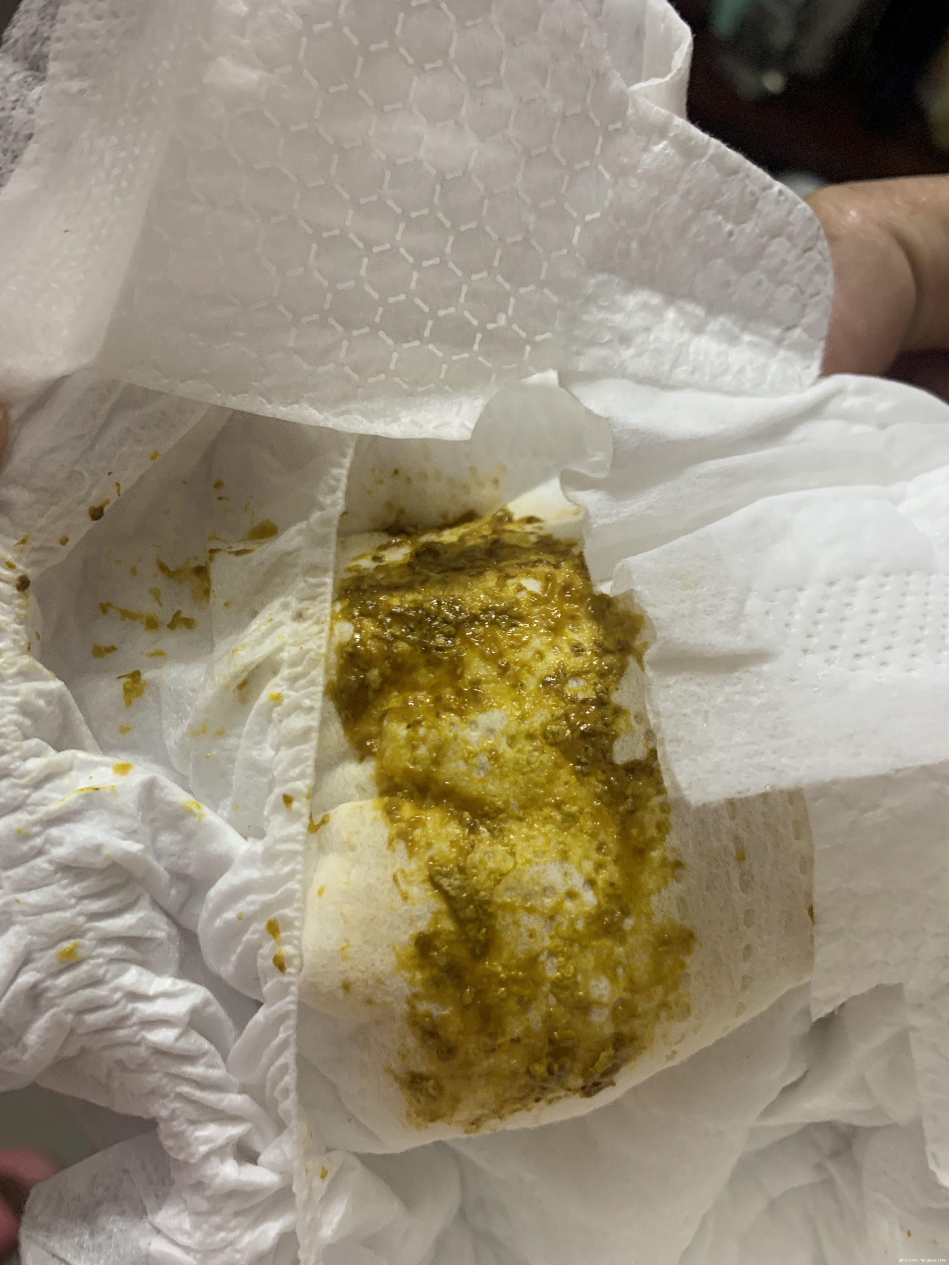 三十几天的宝宝纯母乳喂养哭闹时会拉图一的的大