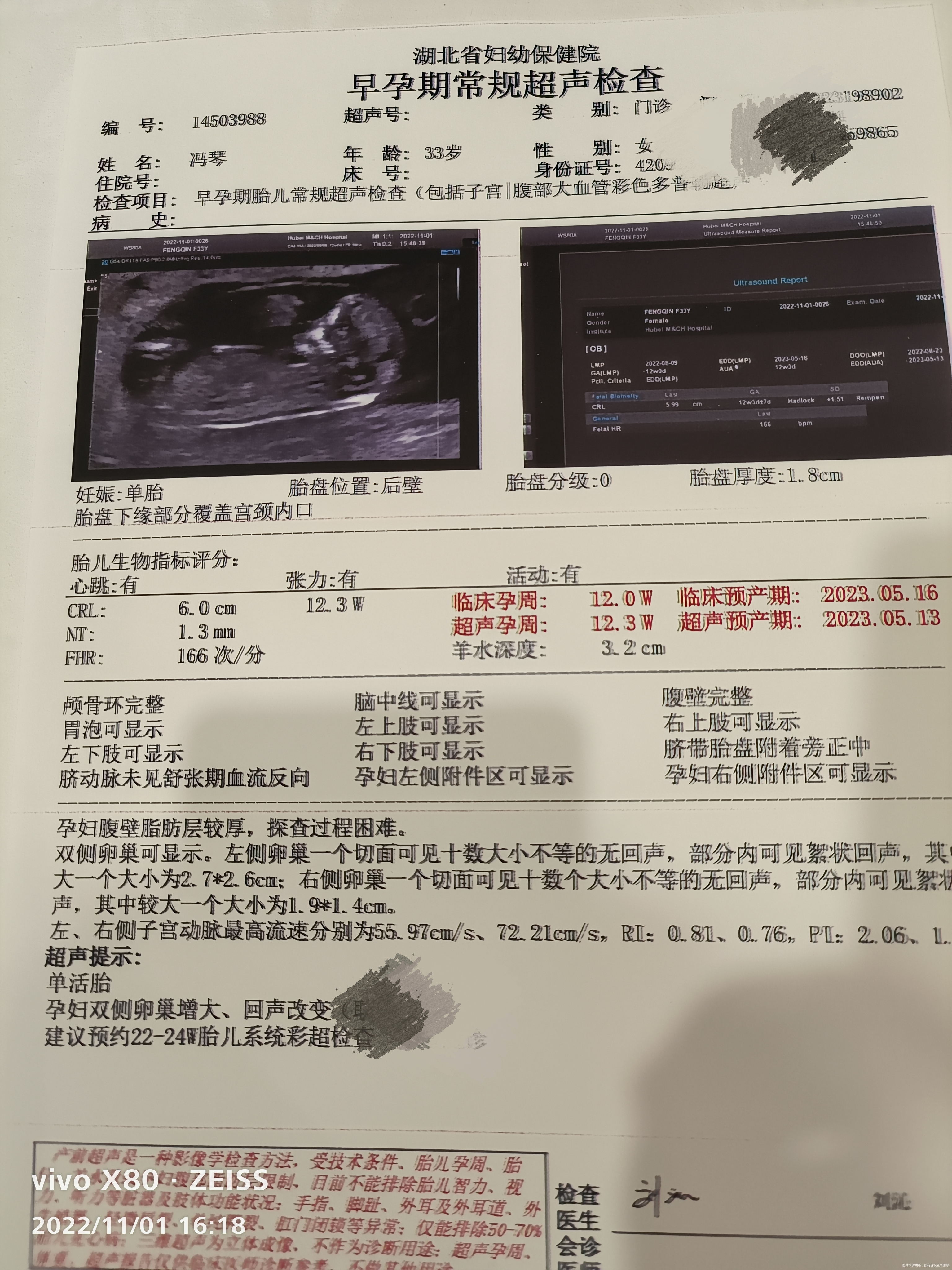 今天是11周+6鲜囊胚移植后的第65天明天医