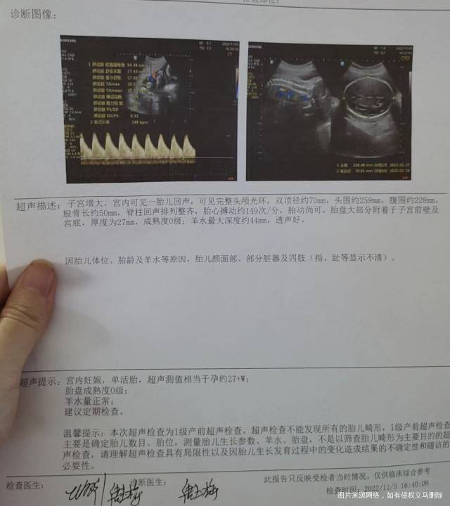 目前孕28周以下是27周+做的B超帮我看下胎