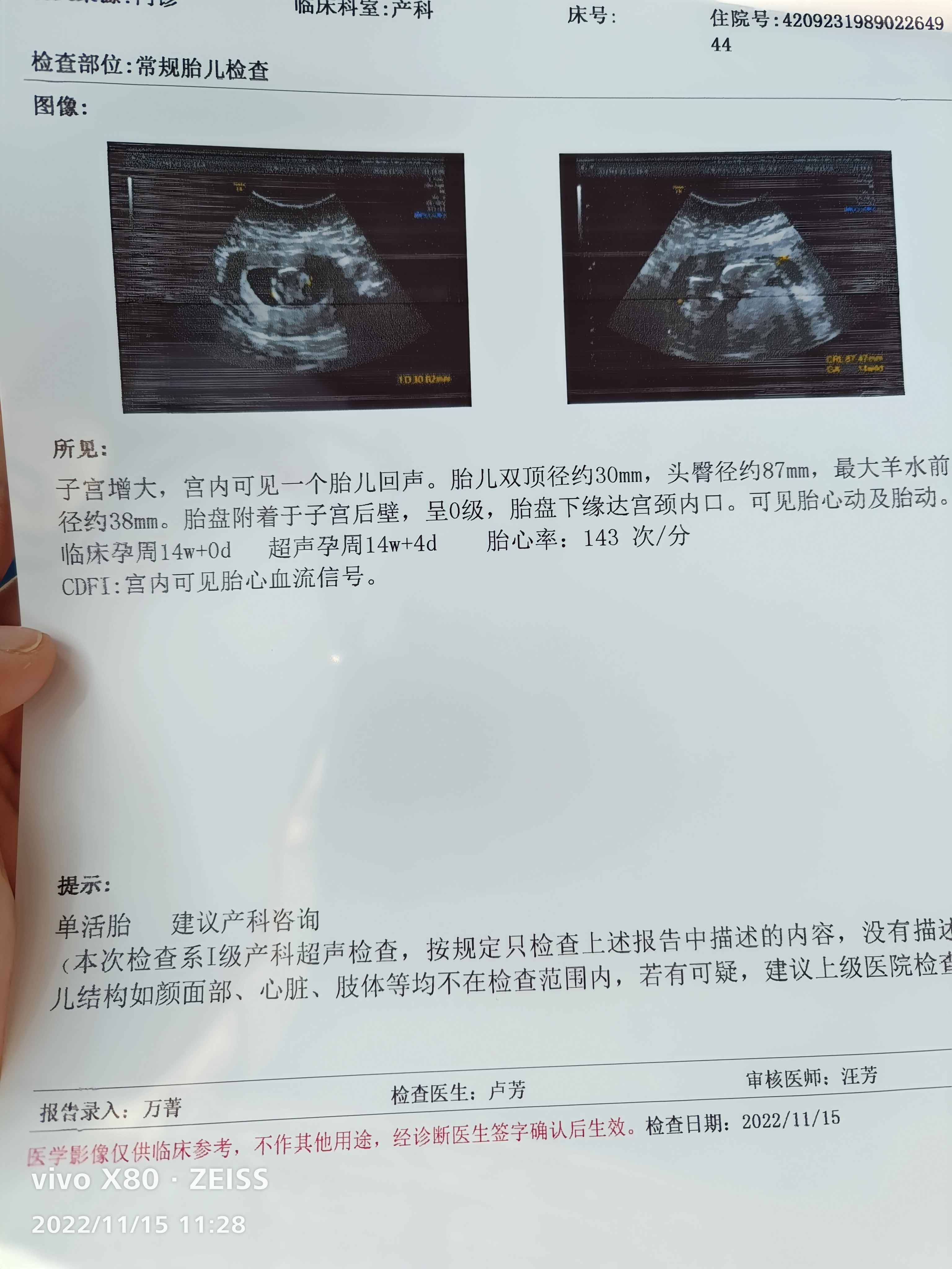 上次12周+3NT的时候胎盘也这样低怎么这都