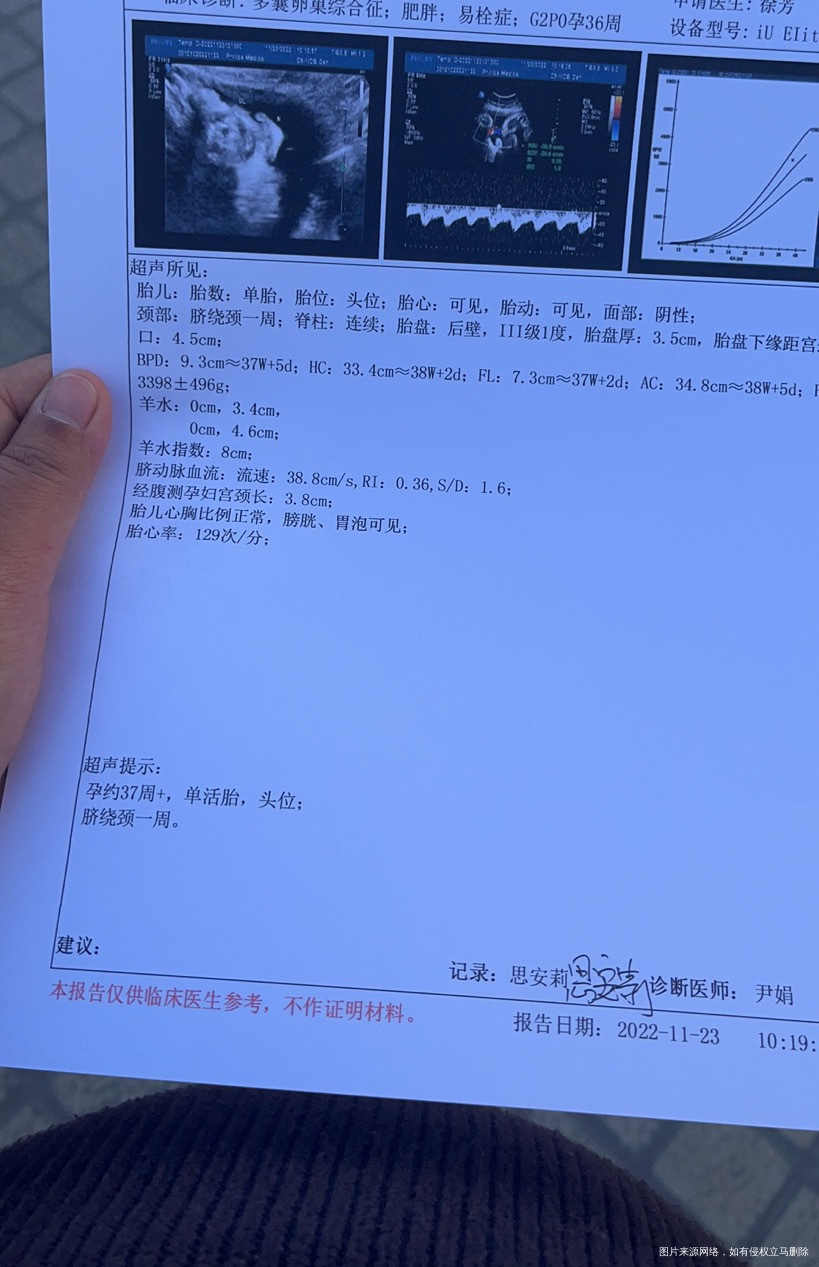 11月23号做b超羊水指数811月26做羊水