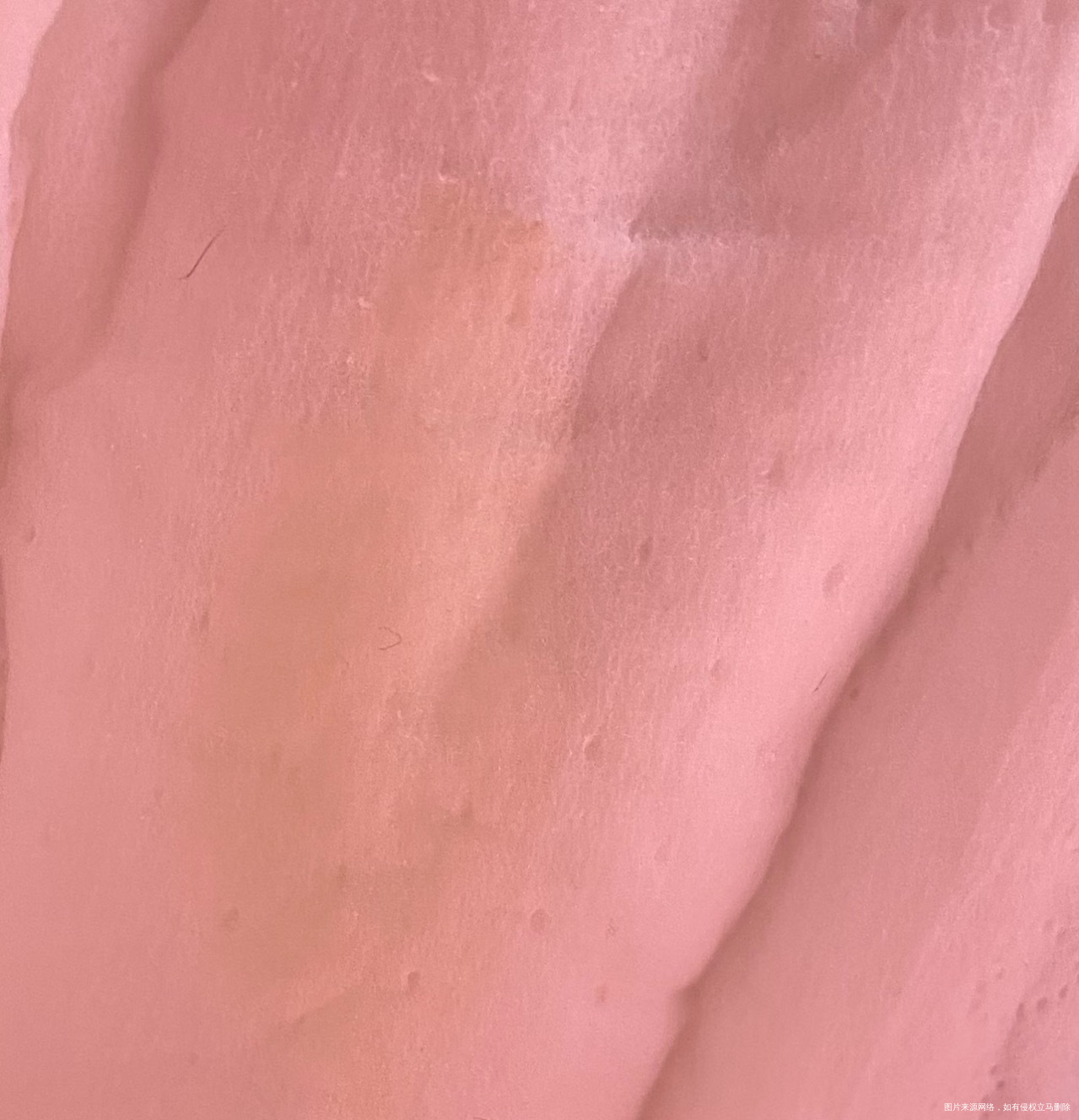 孕早期分泌物有一点发黄正常吗