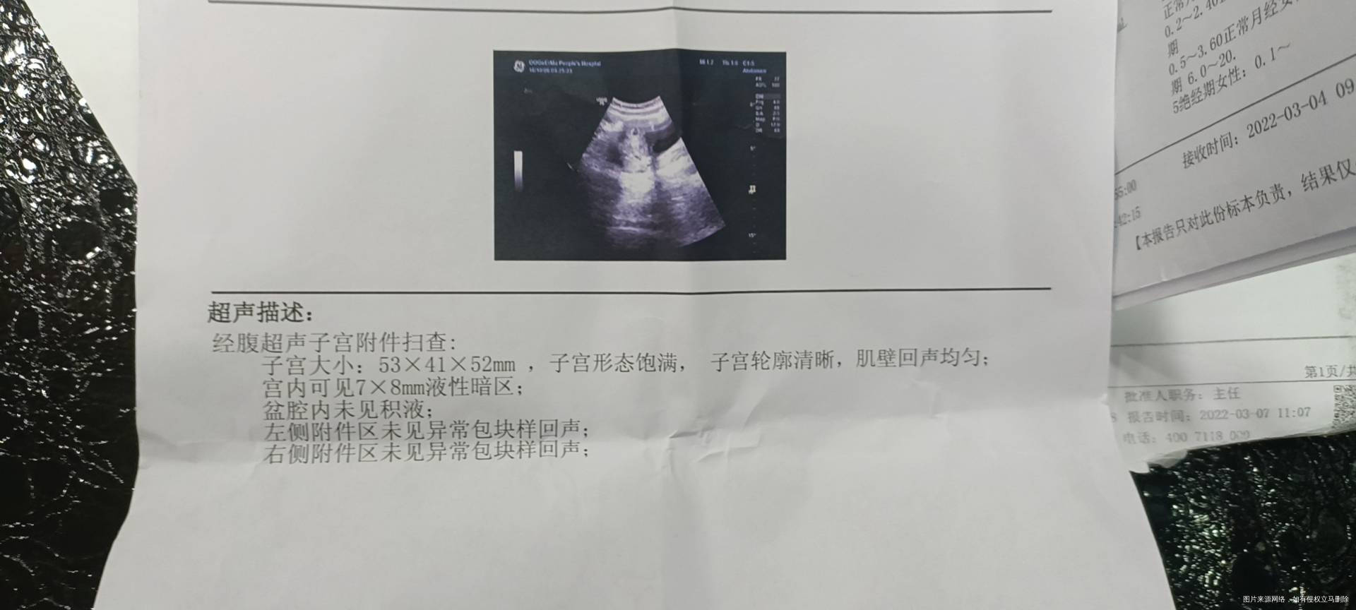 不知道怀孕吃了调经的药鸡血藤三金片益母草藏红