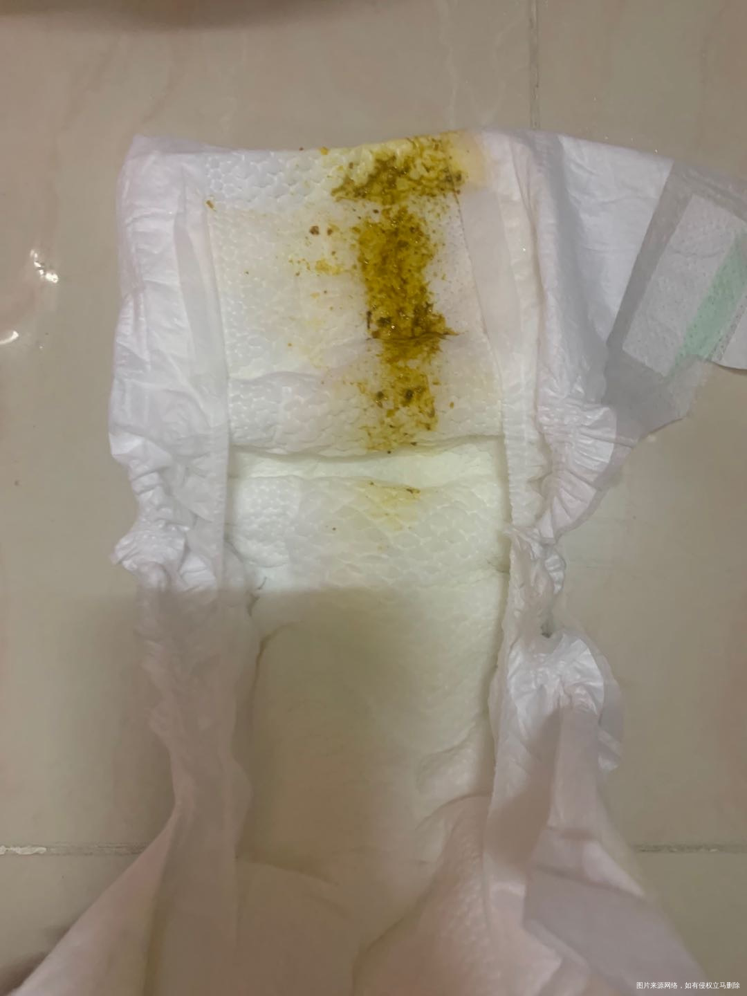 刚满月的宝宝每天拉这样的大便七八次盆里的大便