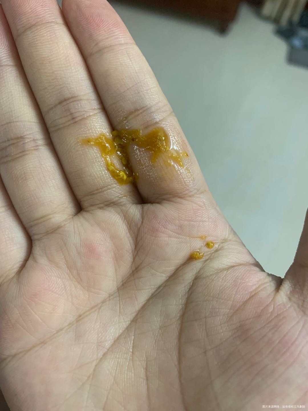 三十几天的宝宝纯母乳喂养哭闹时会拉图一的的大