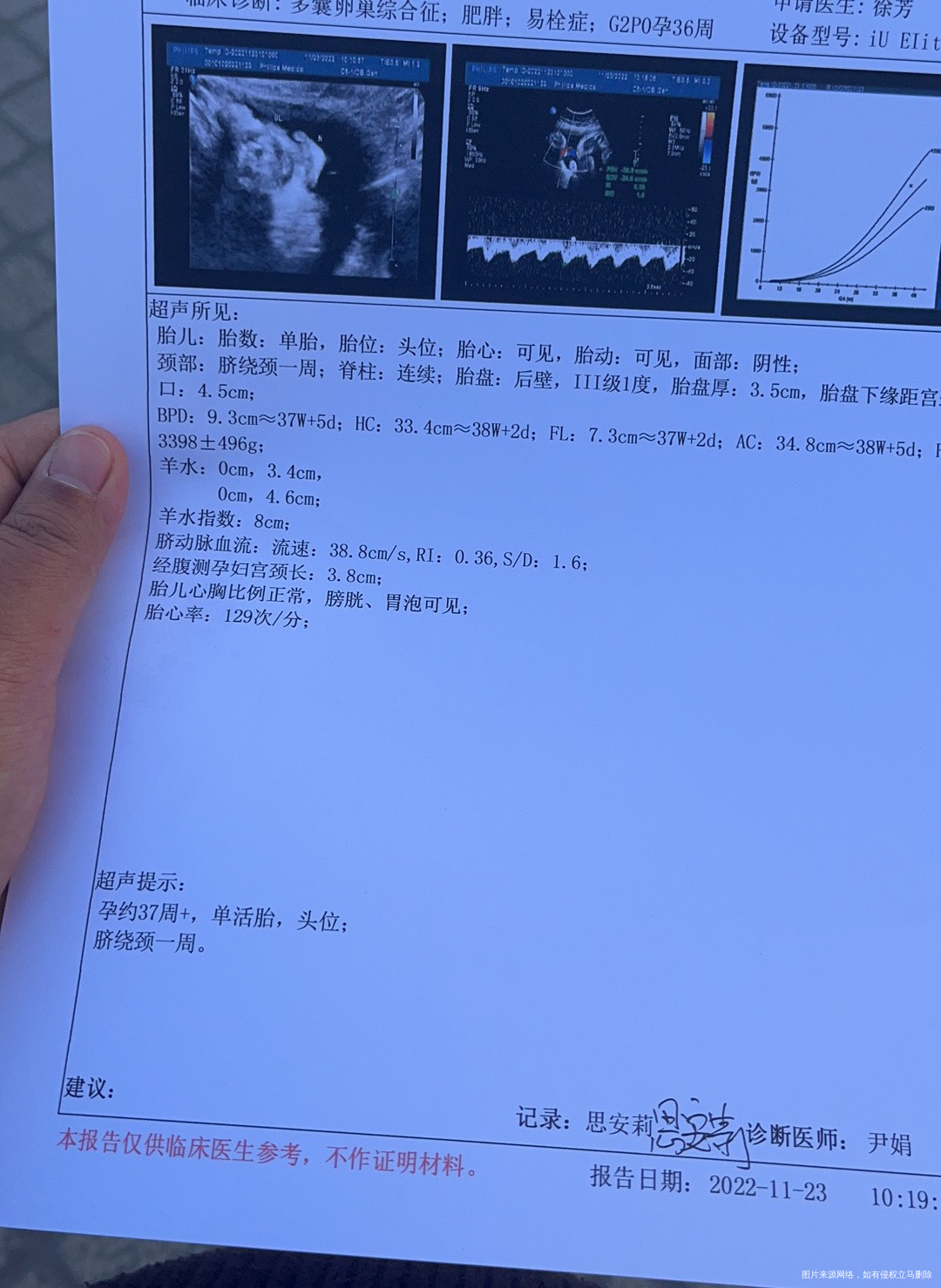 37周今天照b超羊水怎么有两个值是0我这个胎