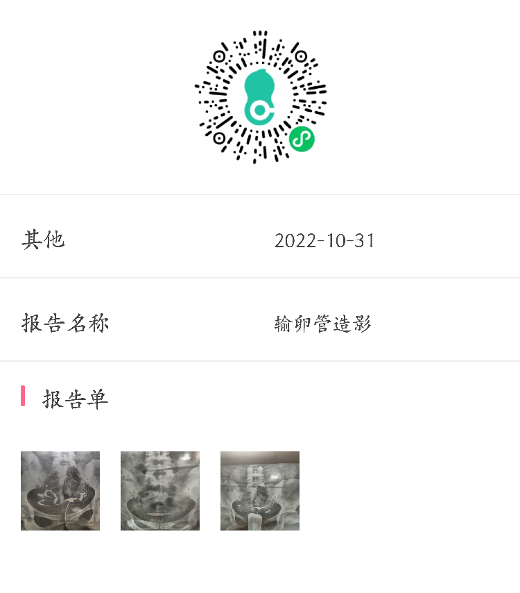 各位医生好前天做了输卵管造影请帮忙看看这些造