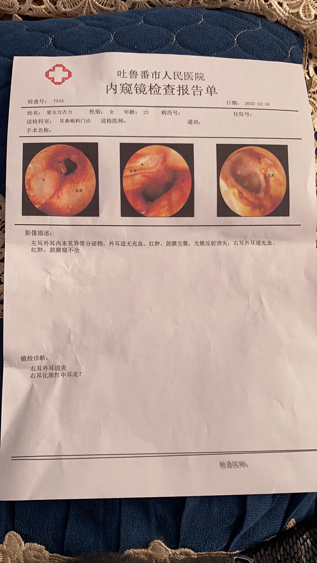 你好医生我现在怀孕31周了大概一个星期了右耳