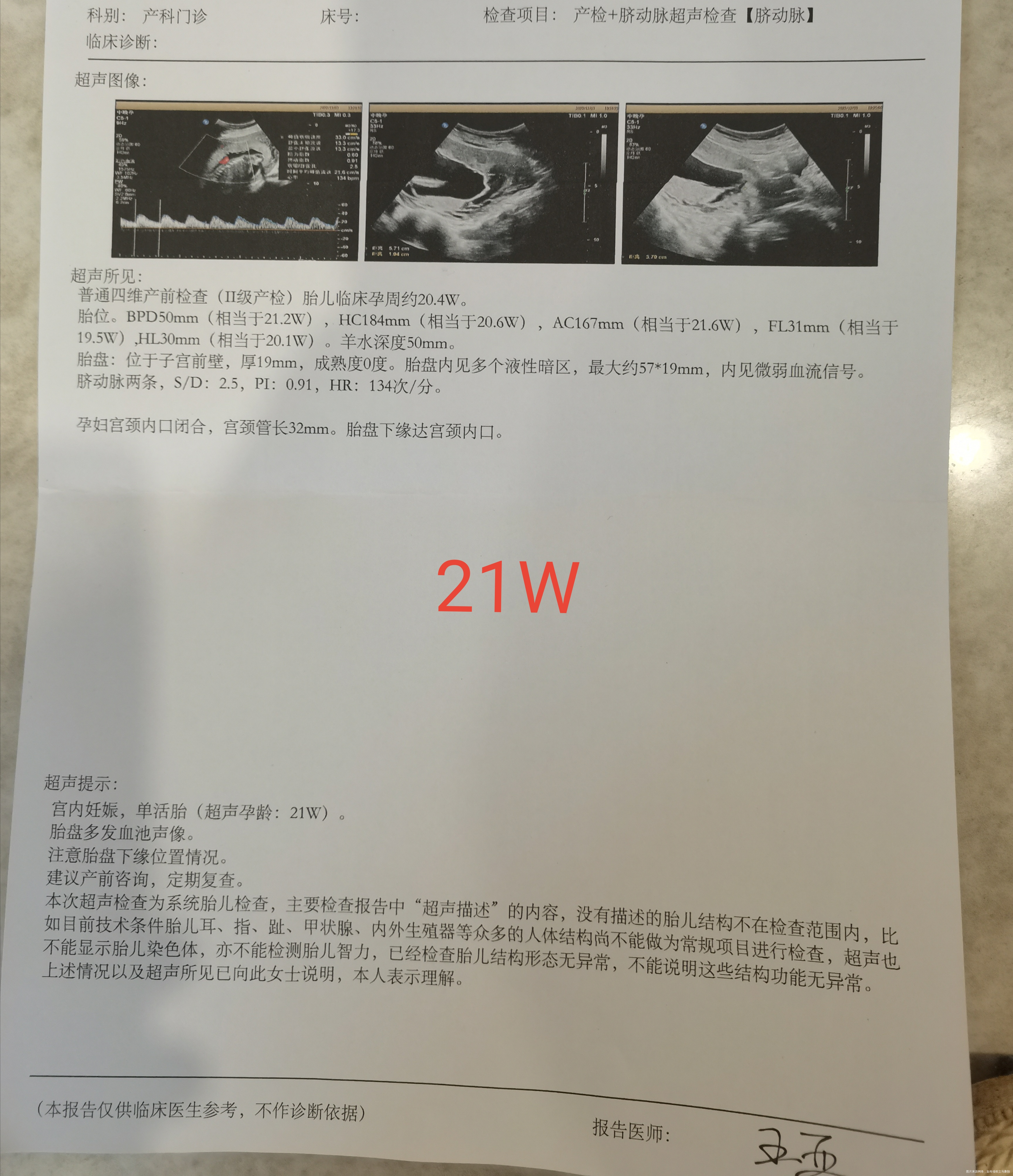 21周突然出现胎盘血池胎盘位置也下降了