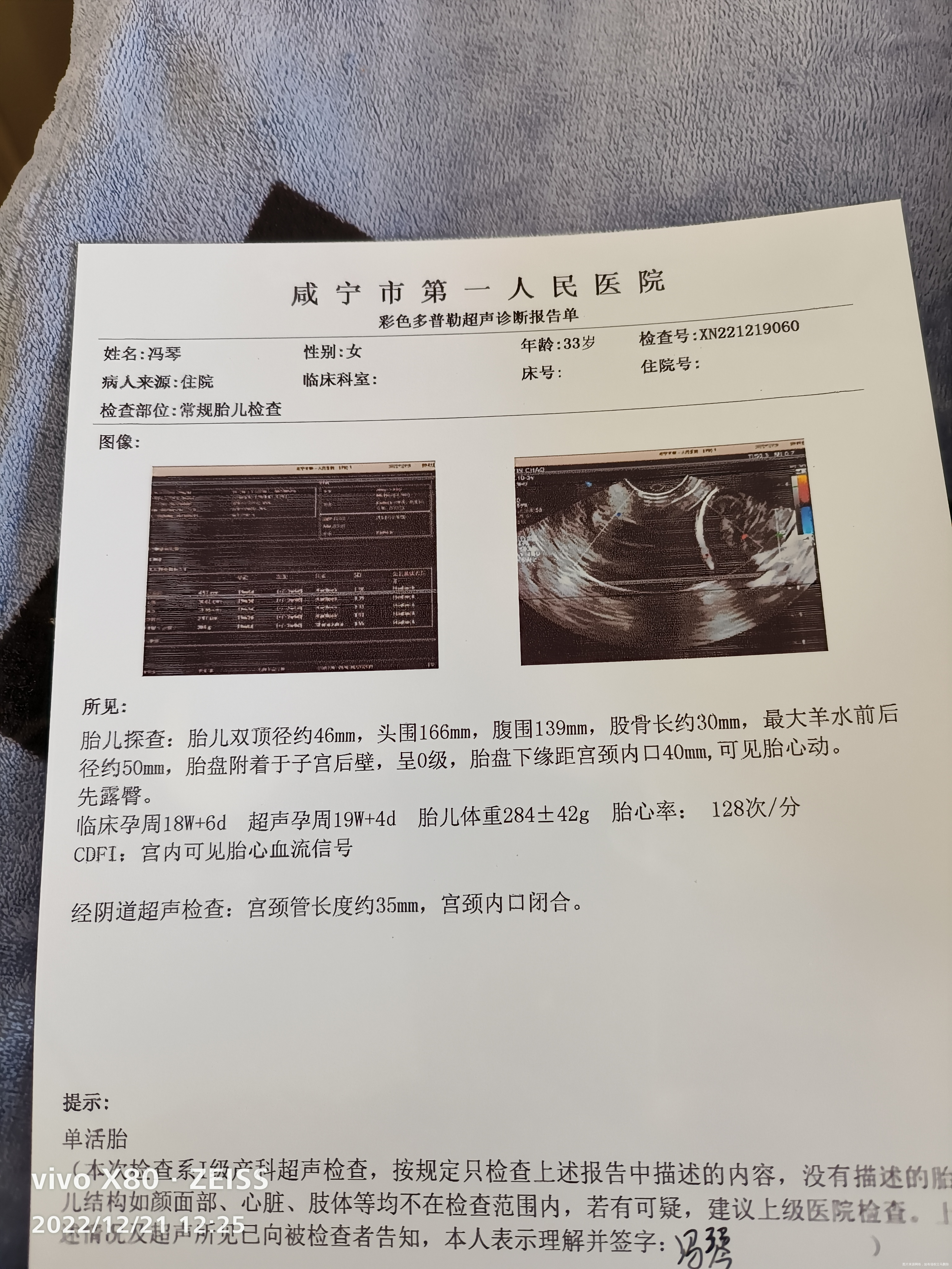 宫颈管长度正常吧胎盘涨上去了我这后期再该注意