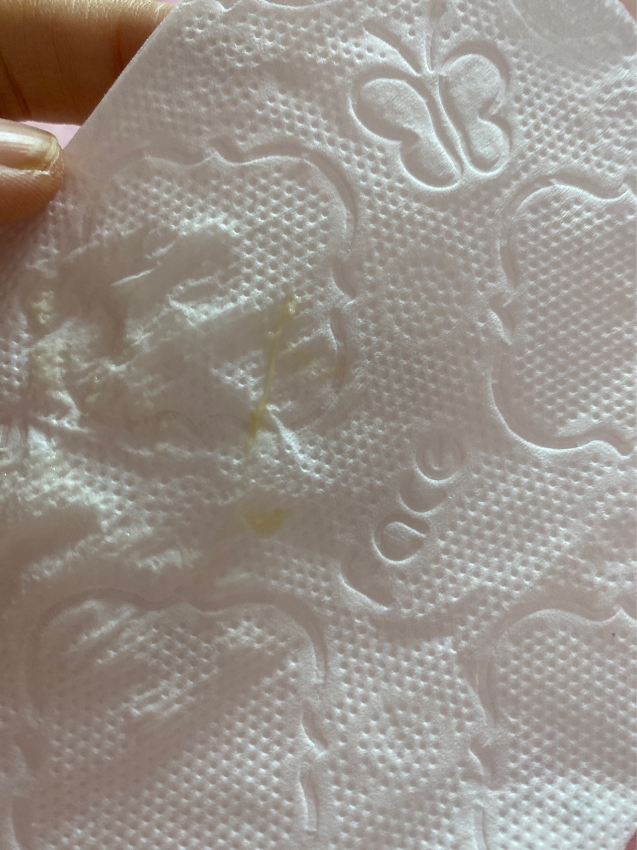 孕早期塞黄体酮胶囊有这个正常吗是白带吗