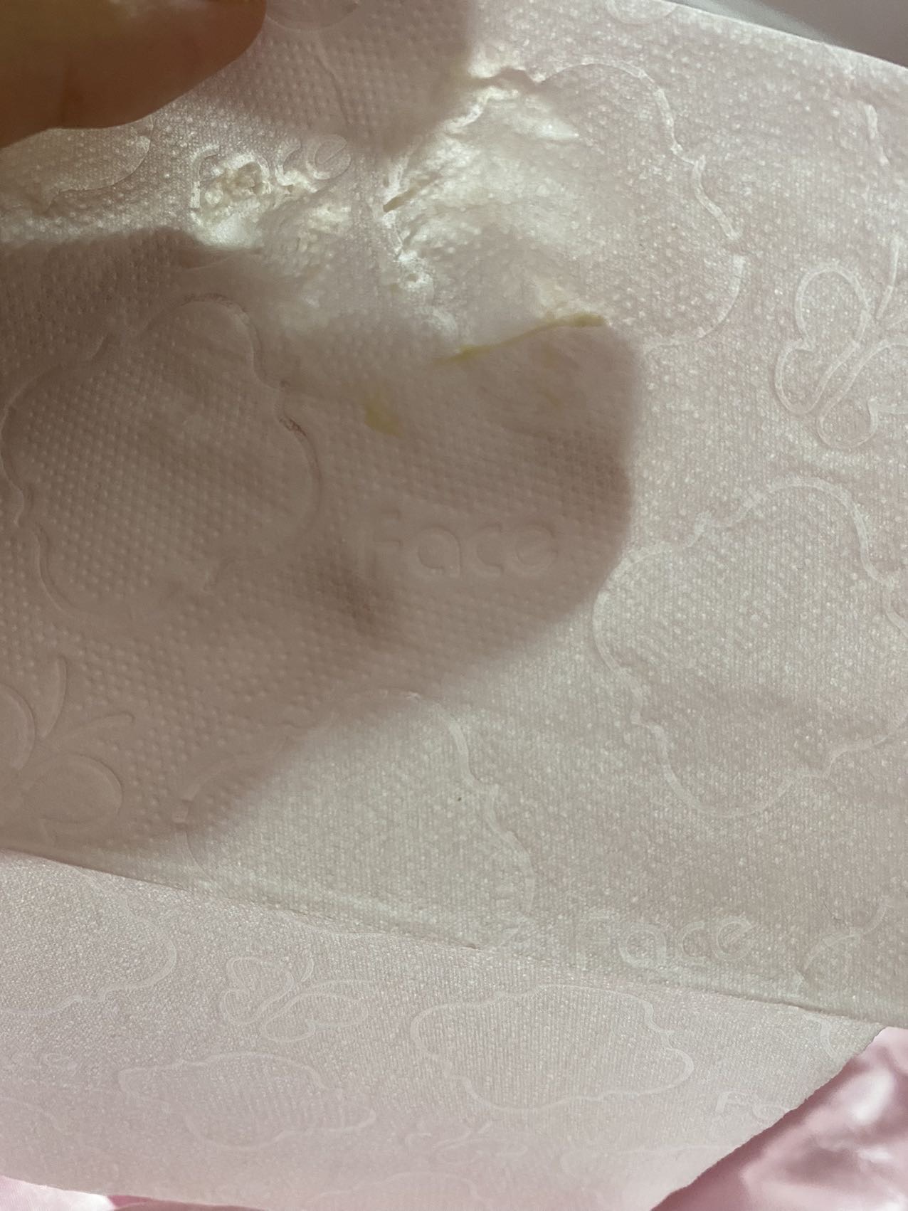 孕早期塞黄体酮胶囊有这个正常吗是白带吗