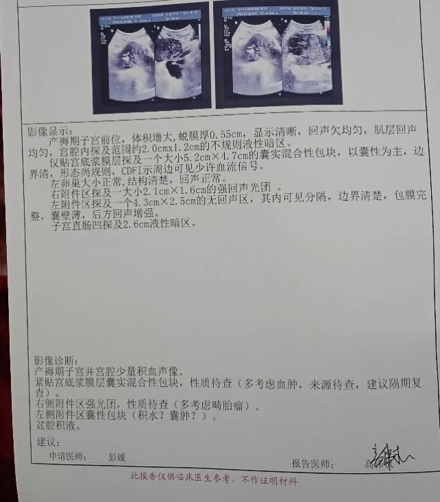 半个月以前刨腹产胎盘植入导致大出血因这两天咳