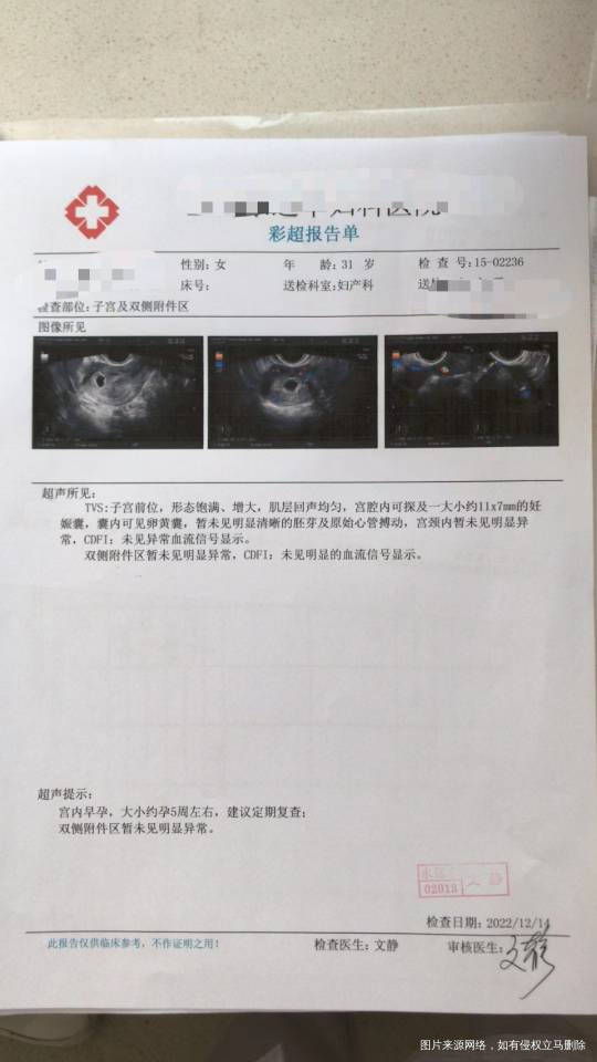 我1116移植一枚4BB囊胚今天去做B超发现