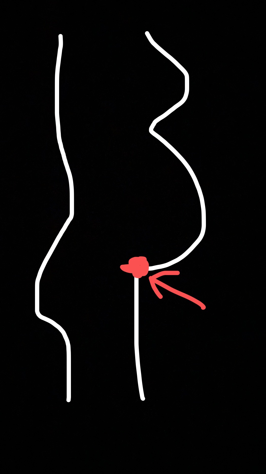 今天按nt算孕周是35加6了从35周告知入盆