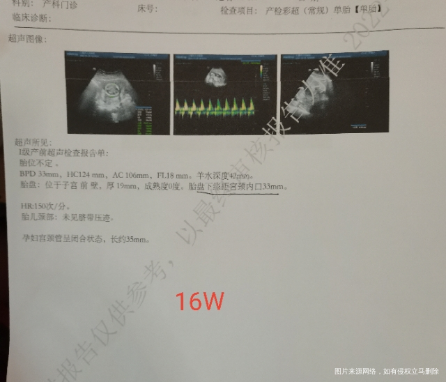 21周突然出现胎盘血池胎盘位置也下降了