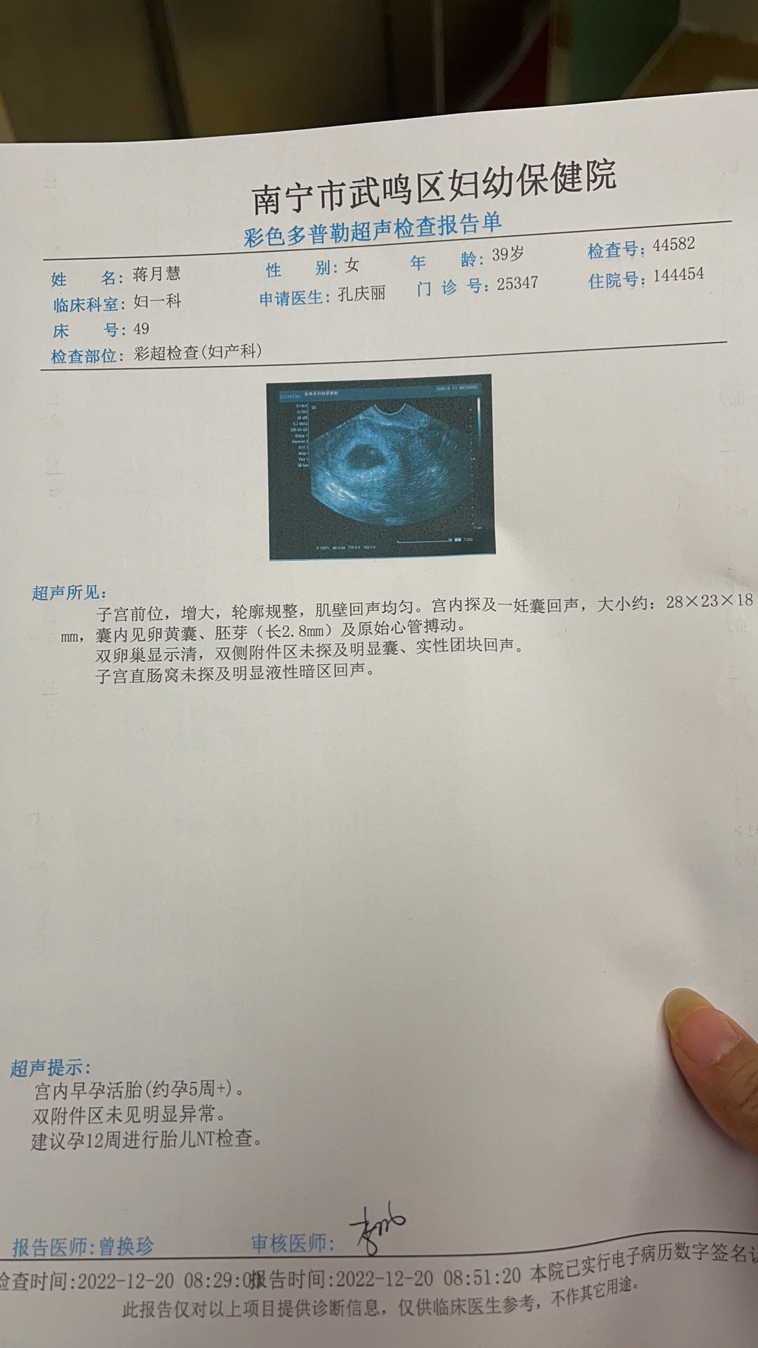 移植囊胚27天一直都有一点点咖啡色的东西排出