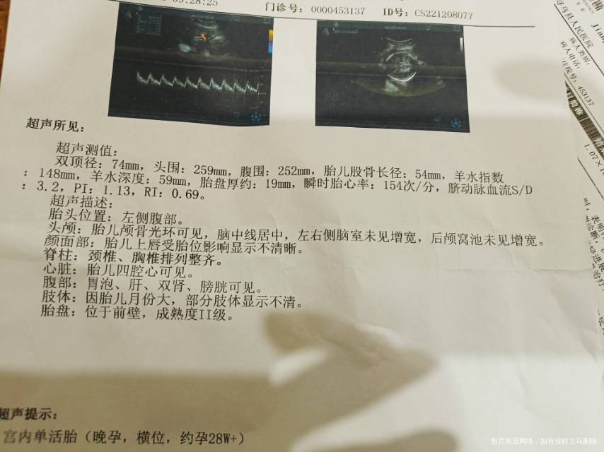 主任想问一下我这算多少斤会不会偏大