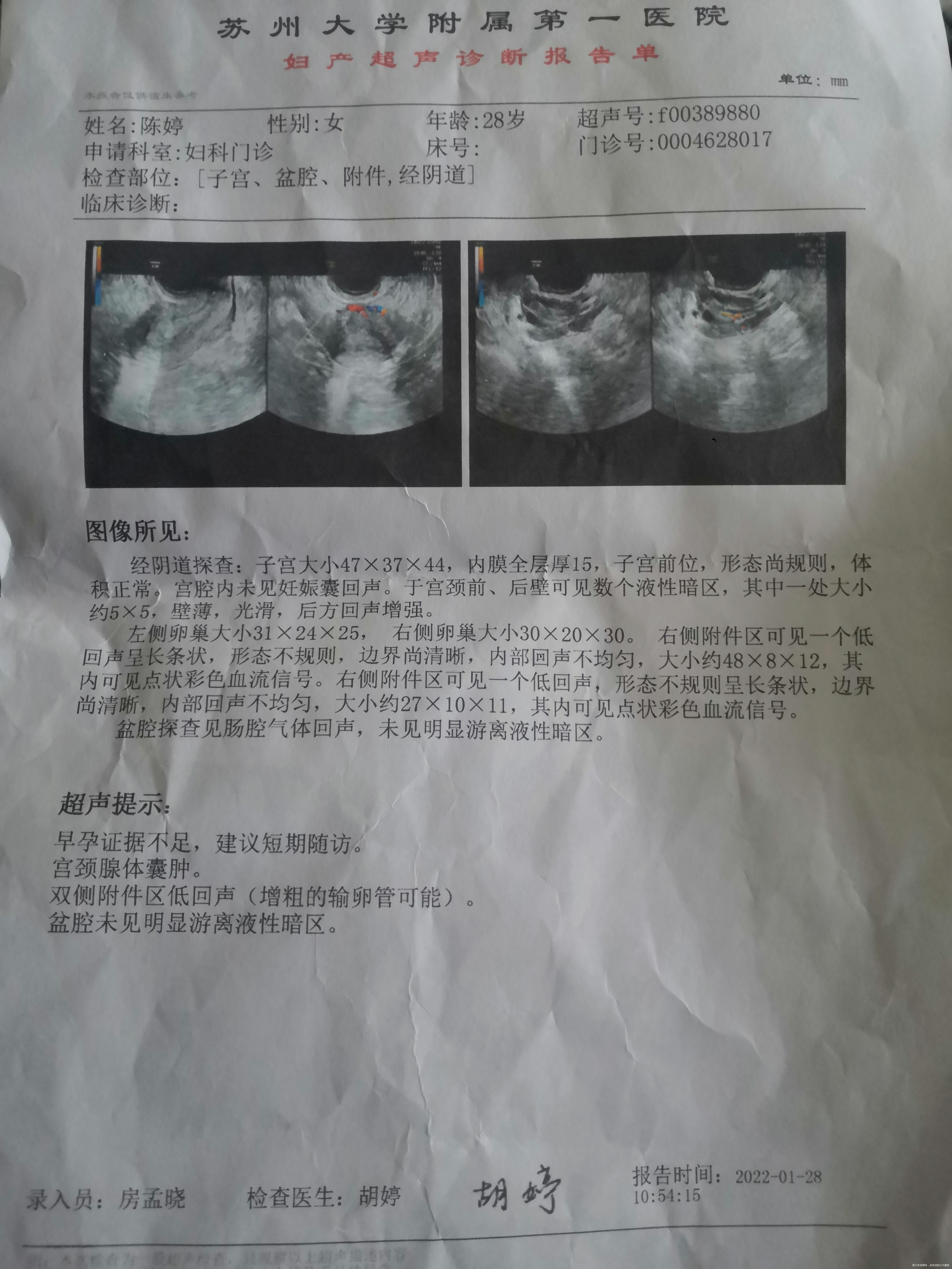 今天我老公摸了我那里然后上厕所擦了一下有褐色