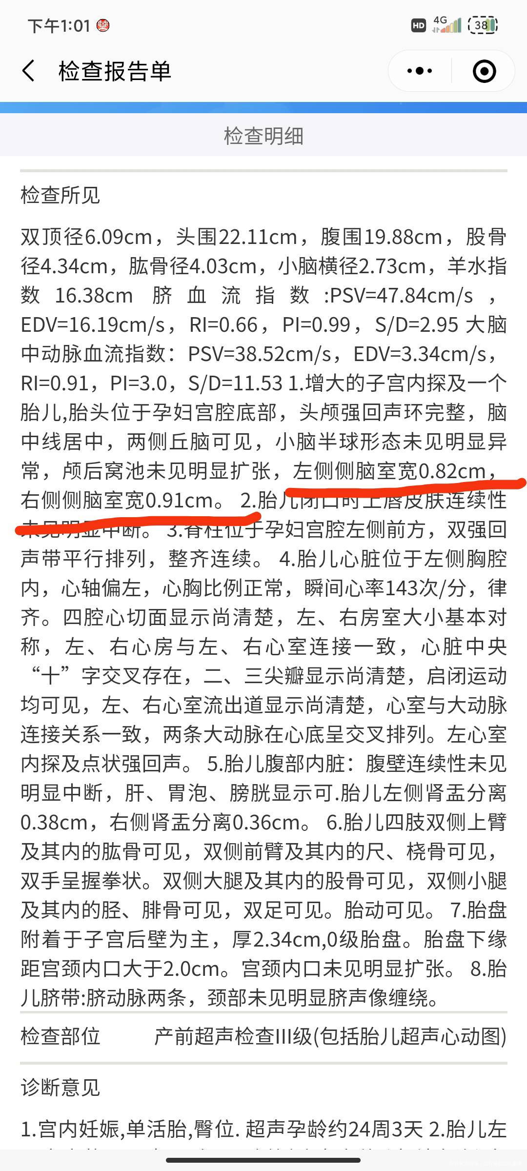 孕24+3三维B超左心室强光点左侧侧脑室08