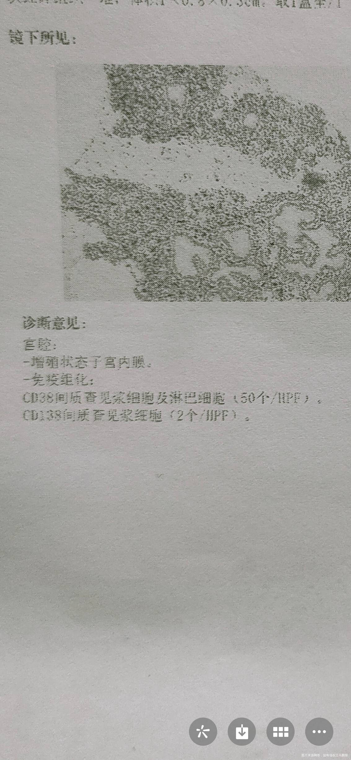 子宫内膜活检请问这个是子宫内膜炎吗严重吗