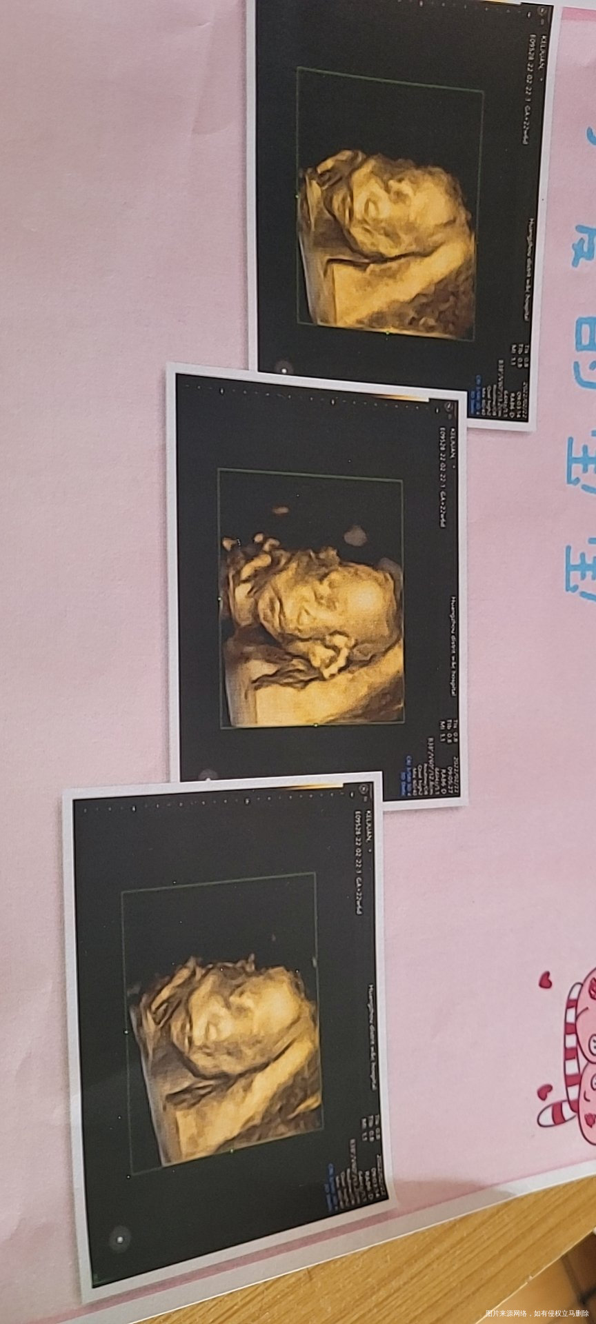 帮我看一看四维正常吗