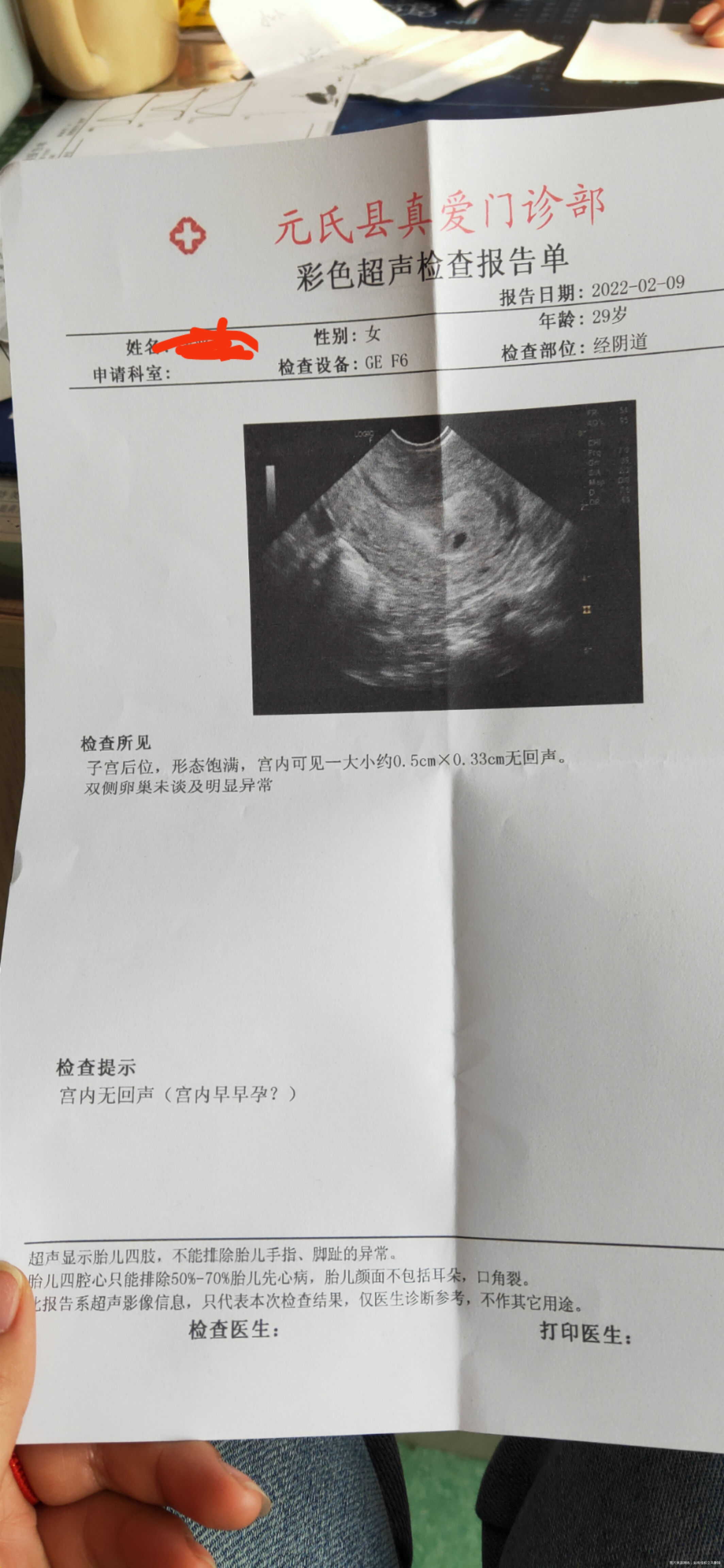 姨妈推迟三天这个值好吗有过三次生化开了保胎药