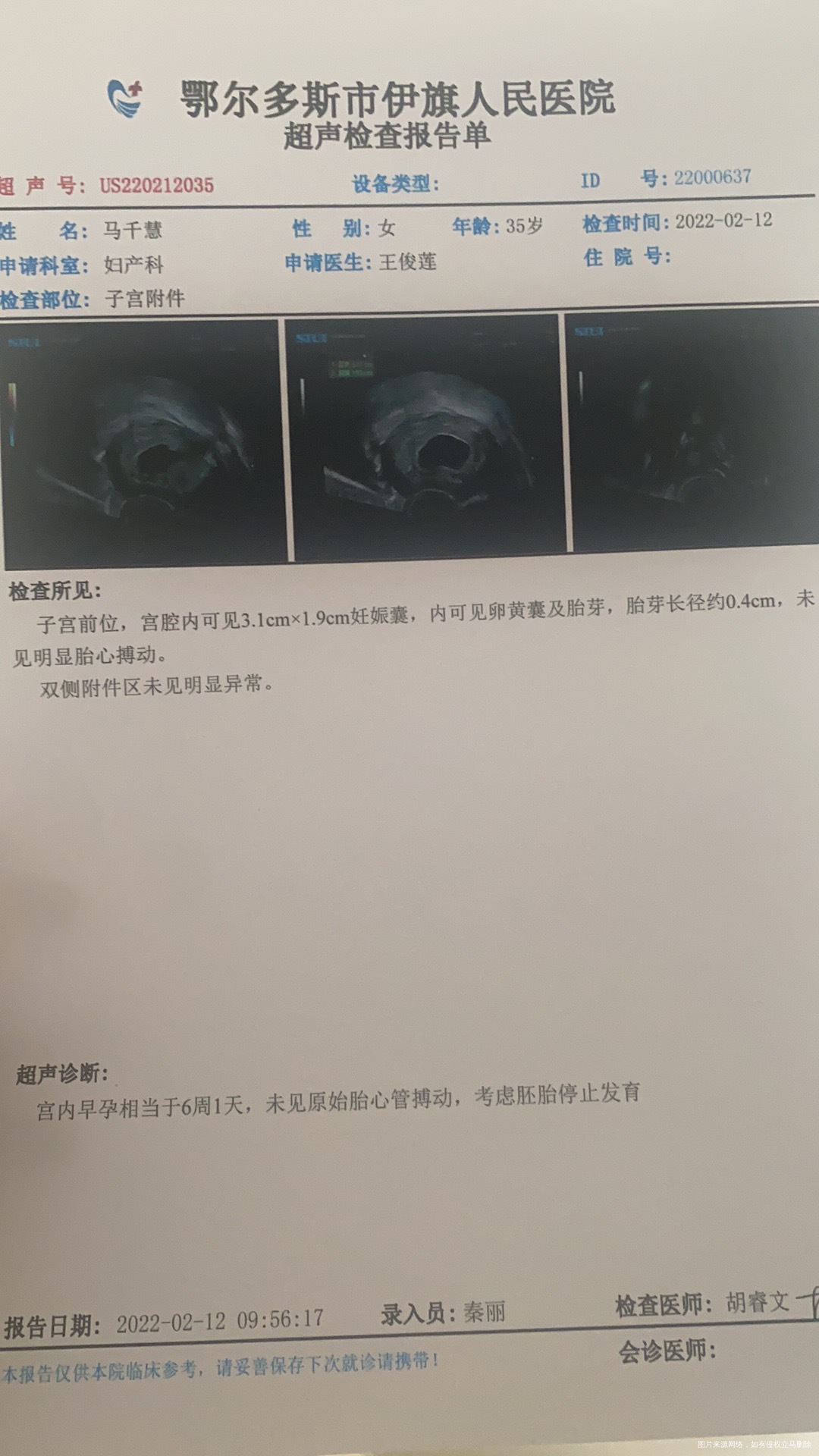 末次月经12月1日完自己预计受孕是12月14