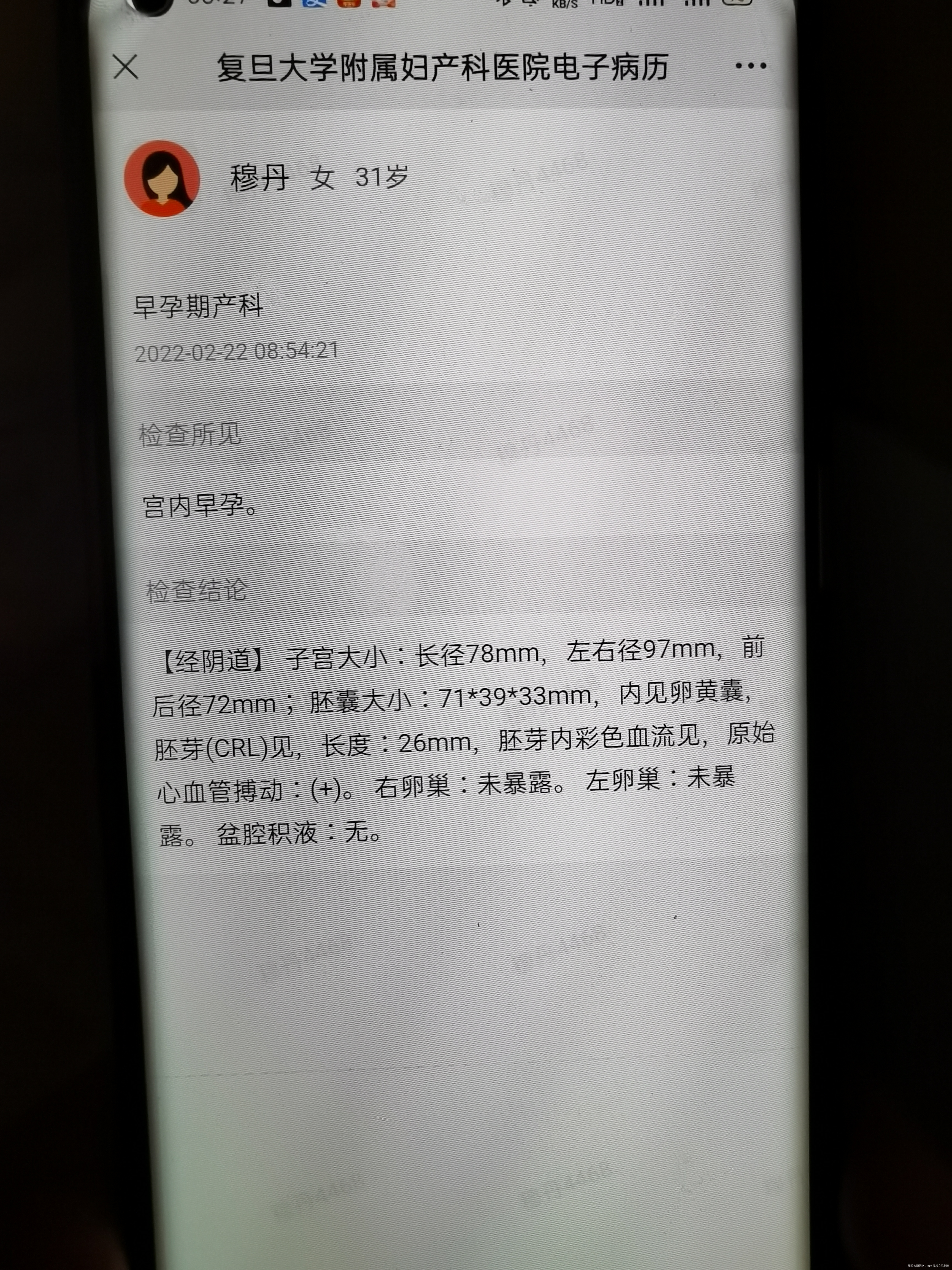 孕妇九周+5妊娠剧吐厉害住院输液治疗+打胃复