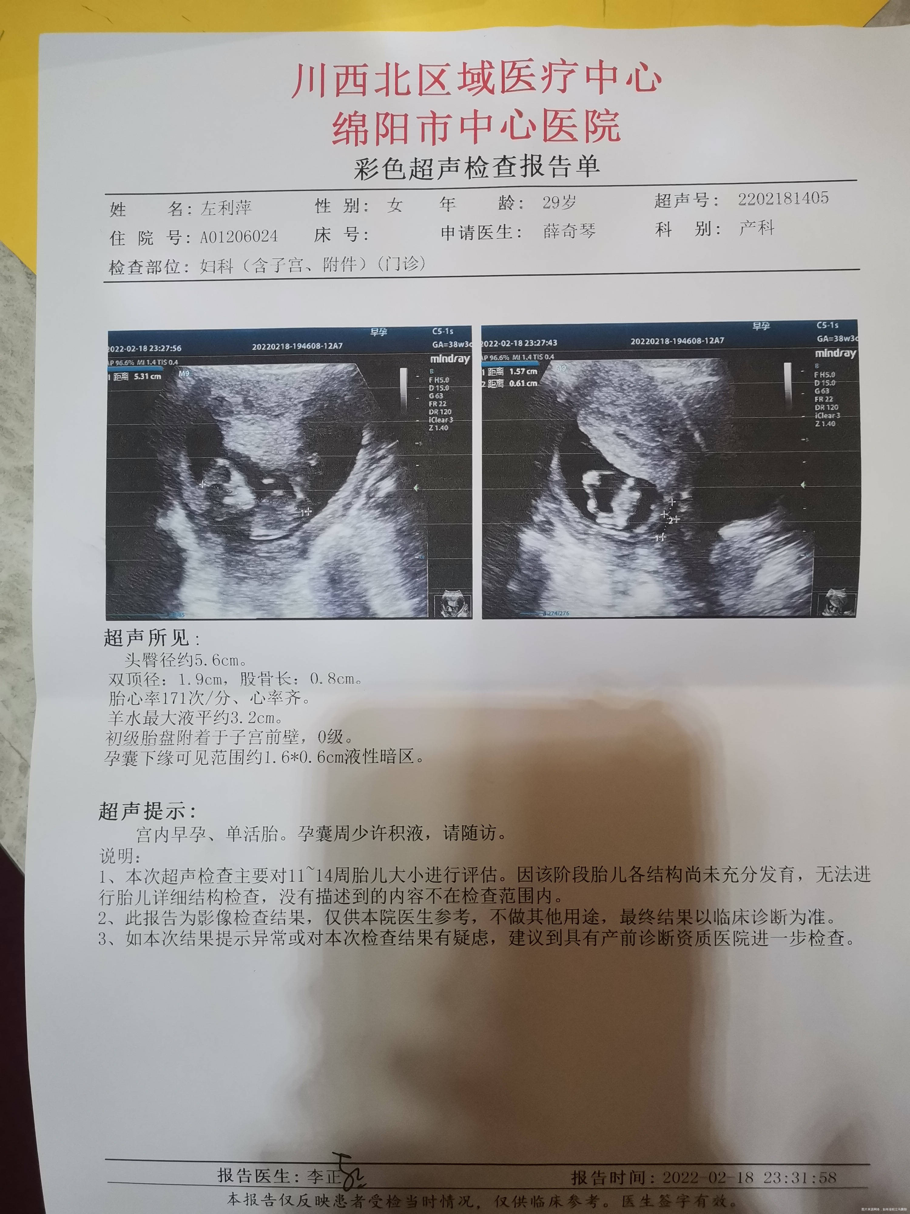 医生您好我是2021年11月16日来的末次月