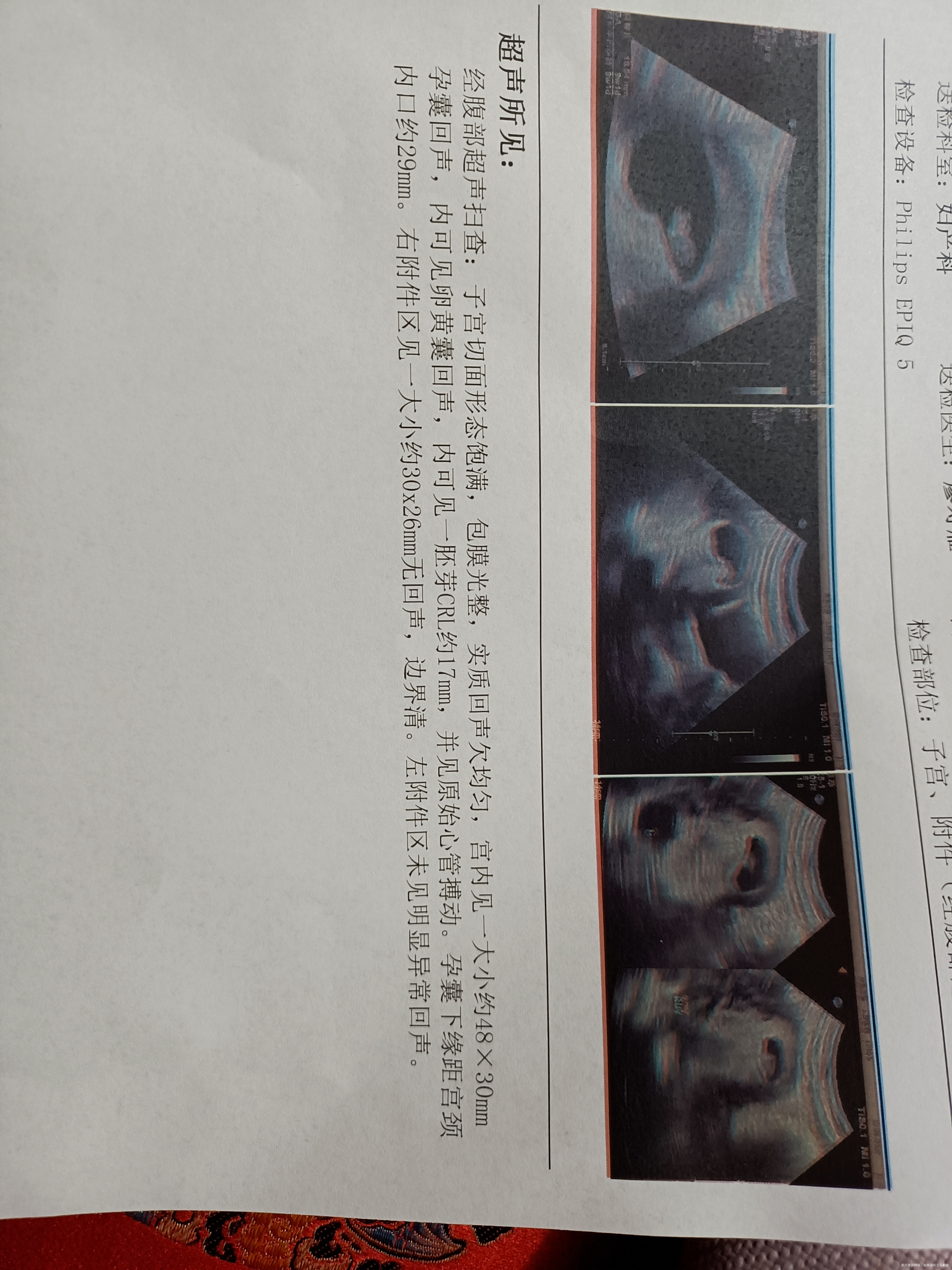 请问我这个是多少周的样子正常吗宝宝