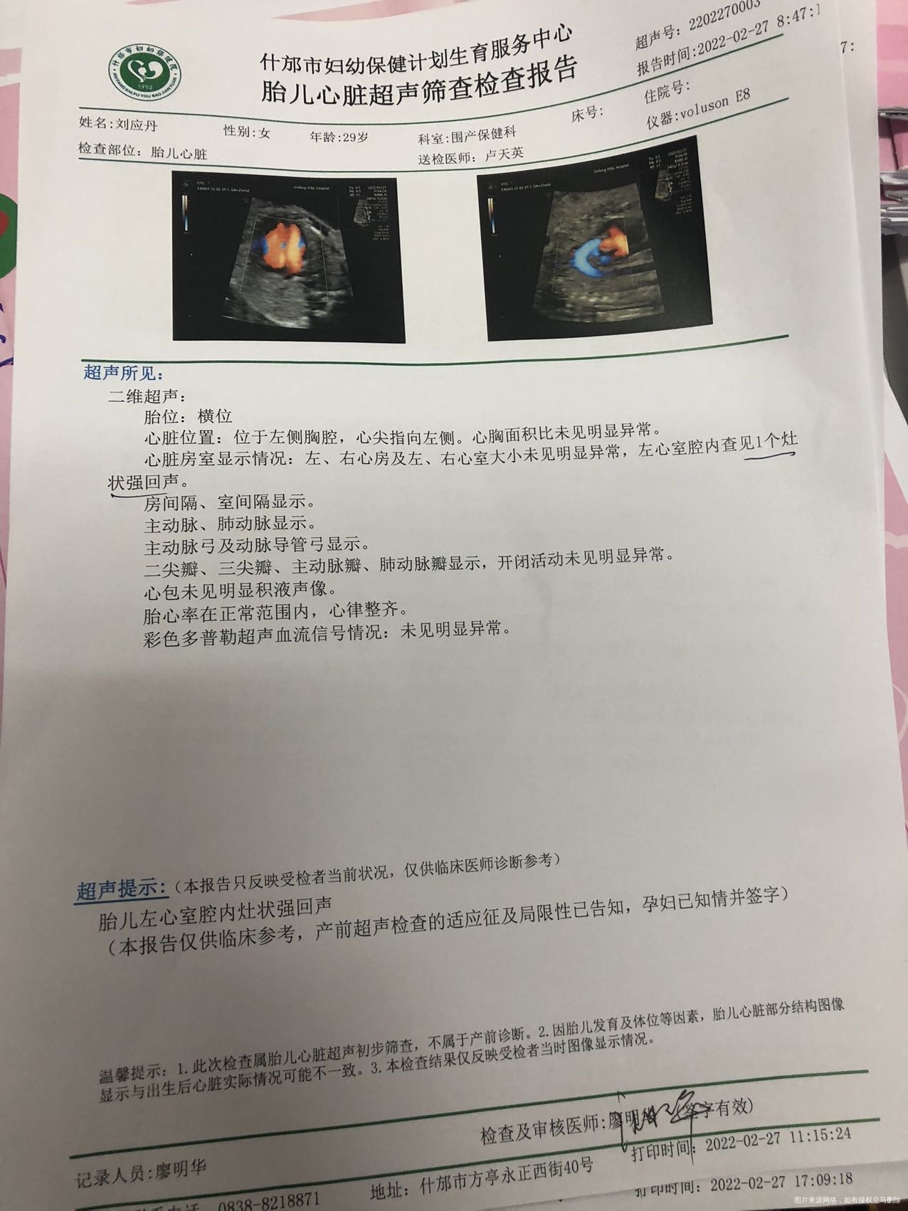 今天做的四维彩超左心室有回声这个问题大吗