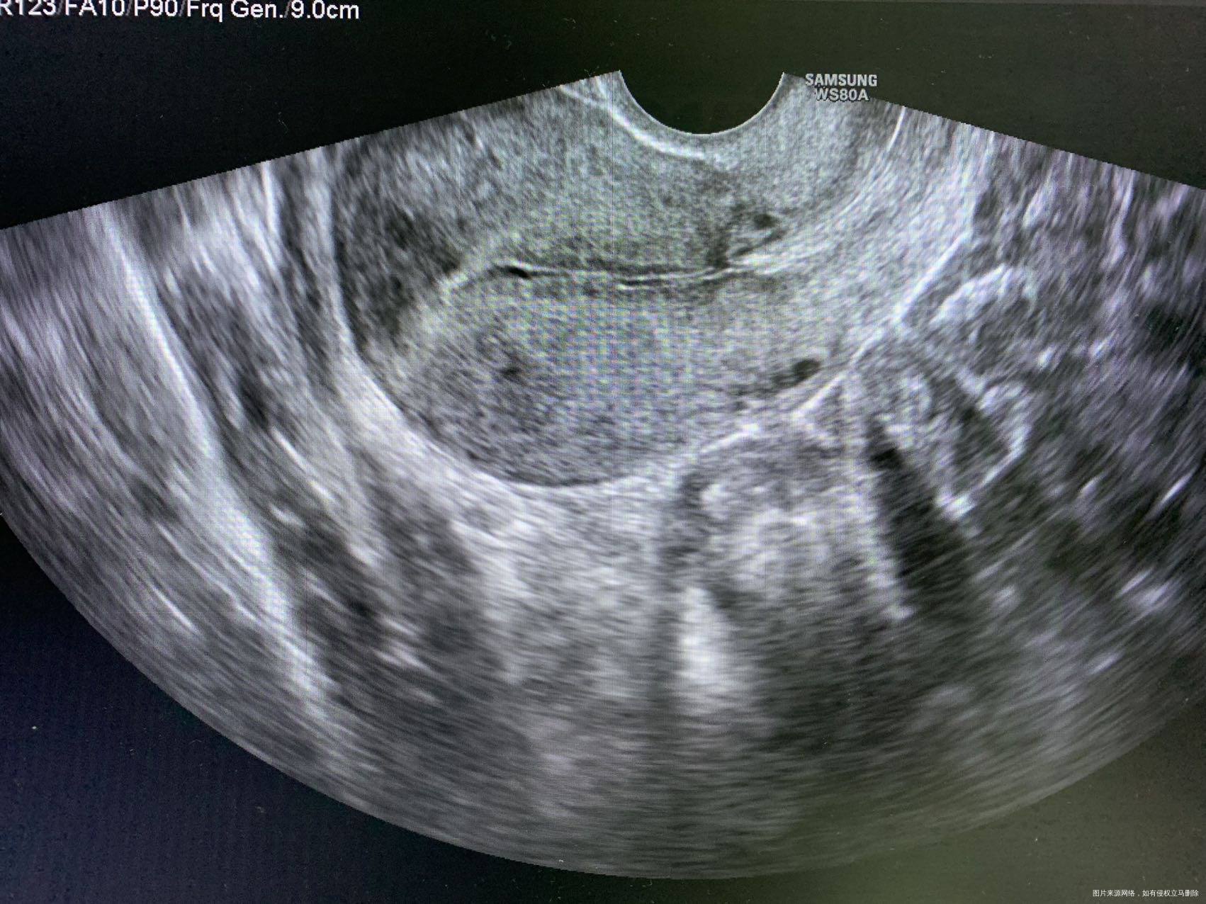 医生帮我看下我重新进入周期了年初四姨妈来了没