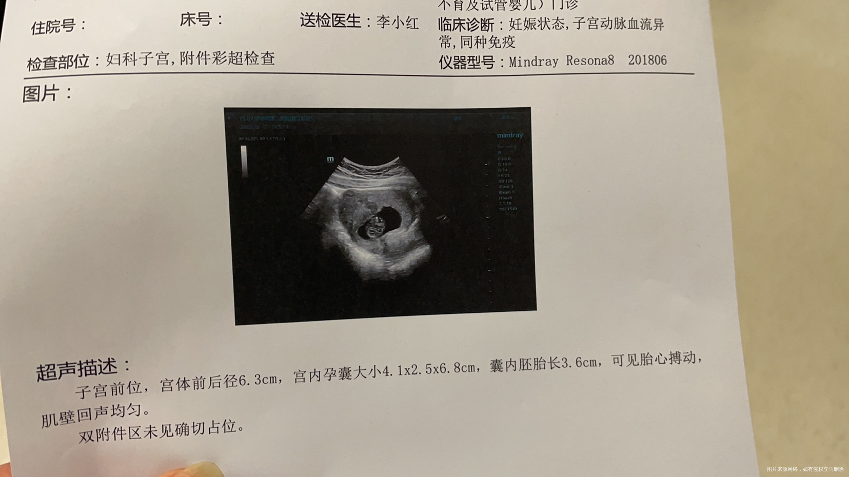 末次月经11月17日12月18日左右排卵月经