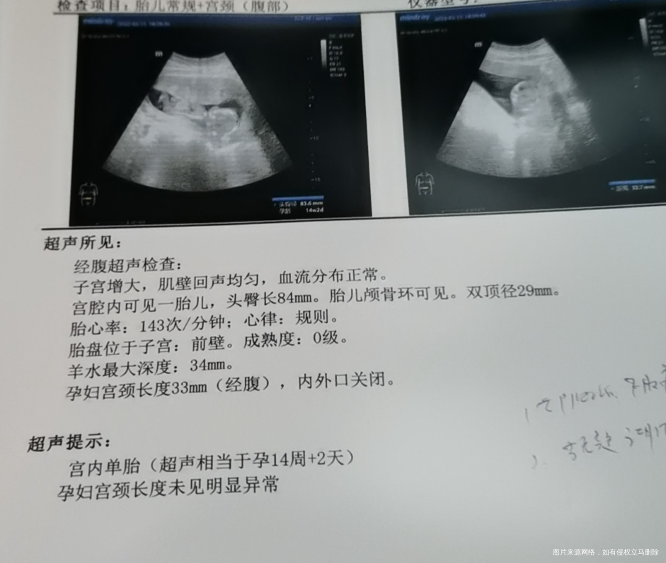 我这个算羊水少吗吃什么涨羊水呢