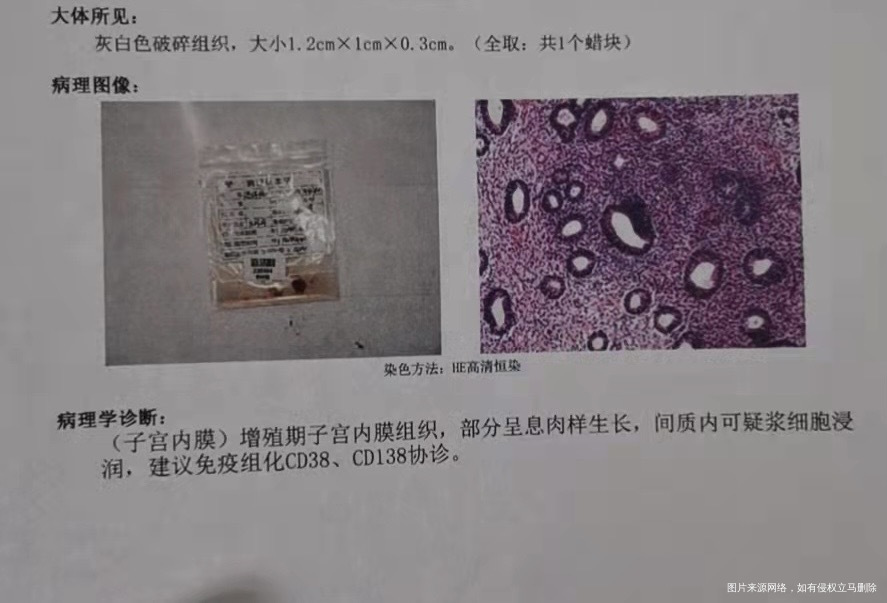 这是内膜的检测报告这是什么意思呀