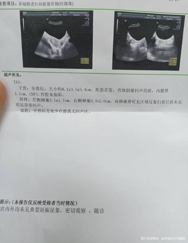 图一是昨天刚查的孕40天结果晚上就腹痛出血今