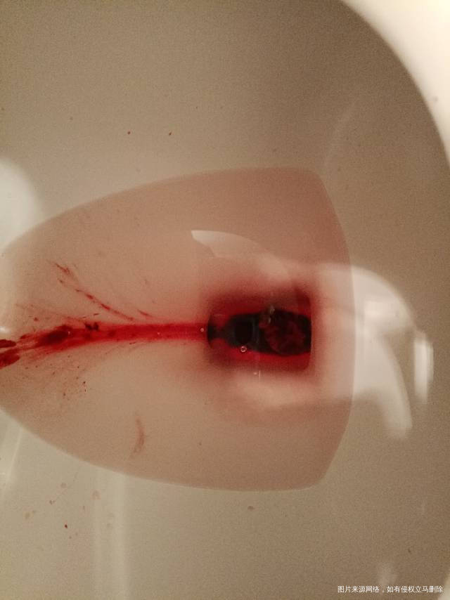 孕6周孕酮极低最近三天一直少量出血并且越来越