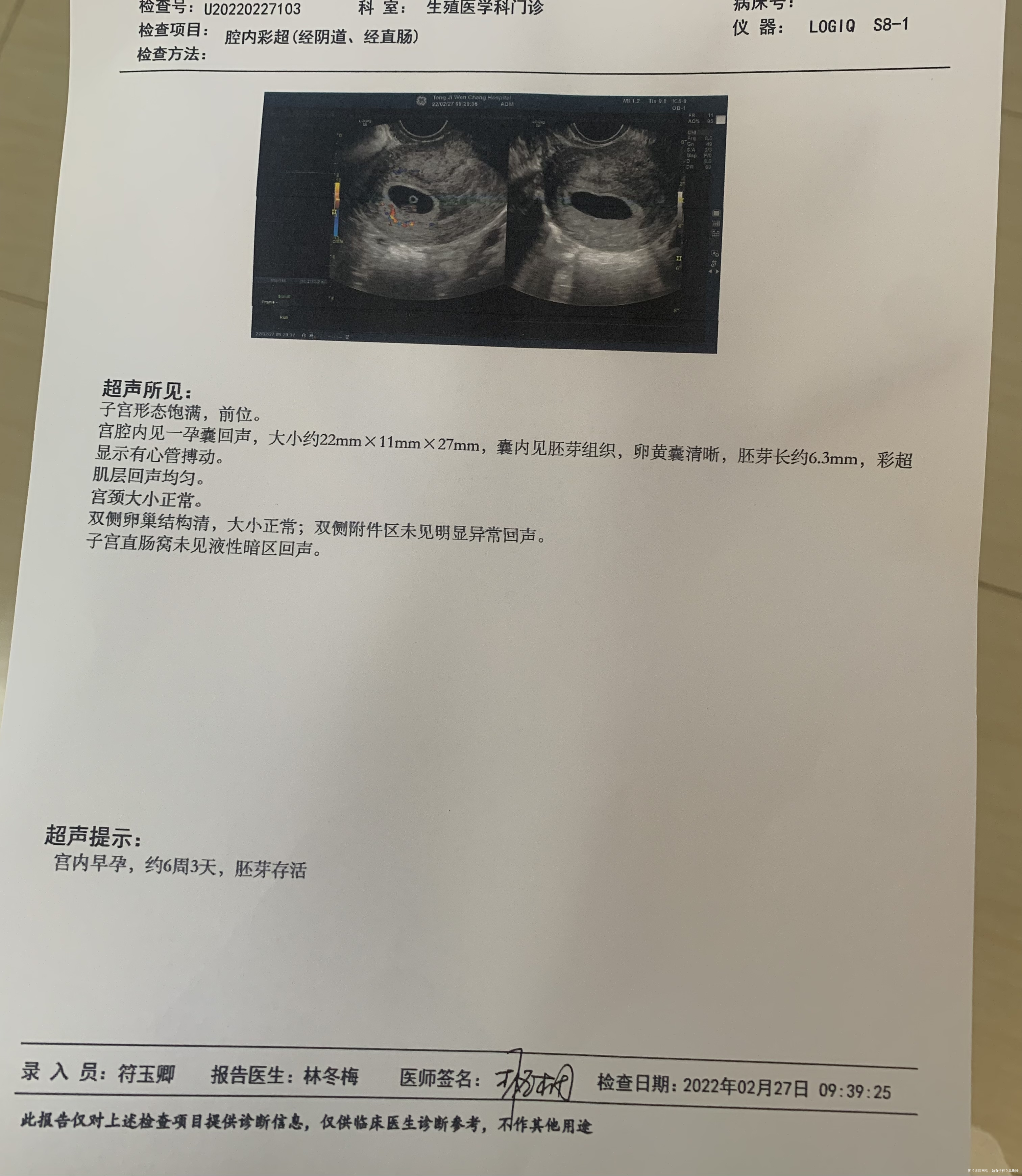 我1月8号末次月经24号排卵2月20号连续流