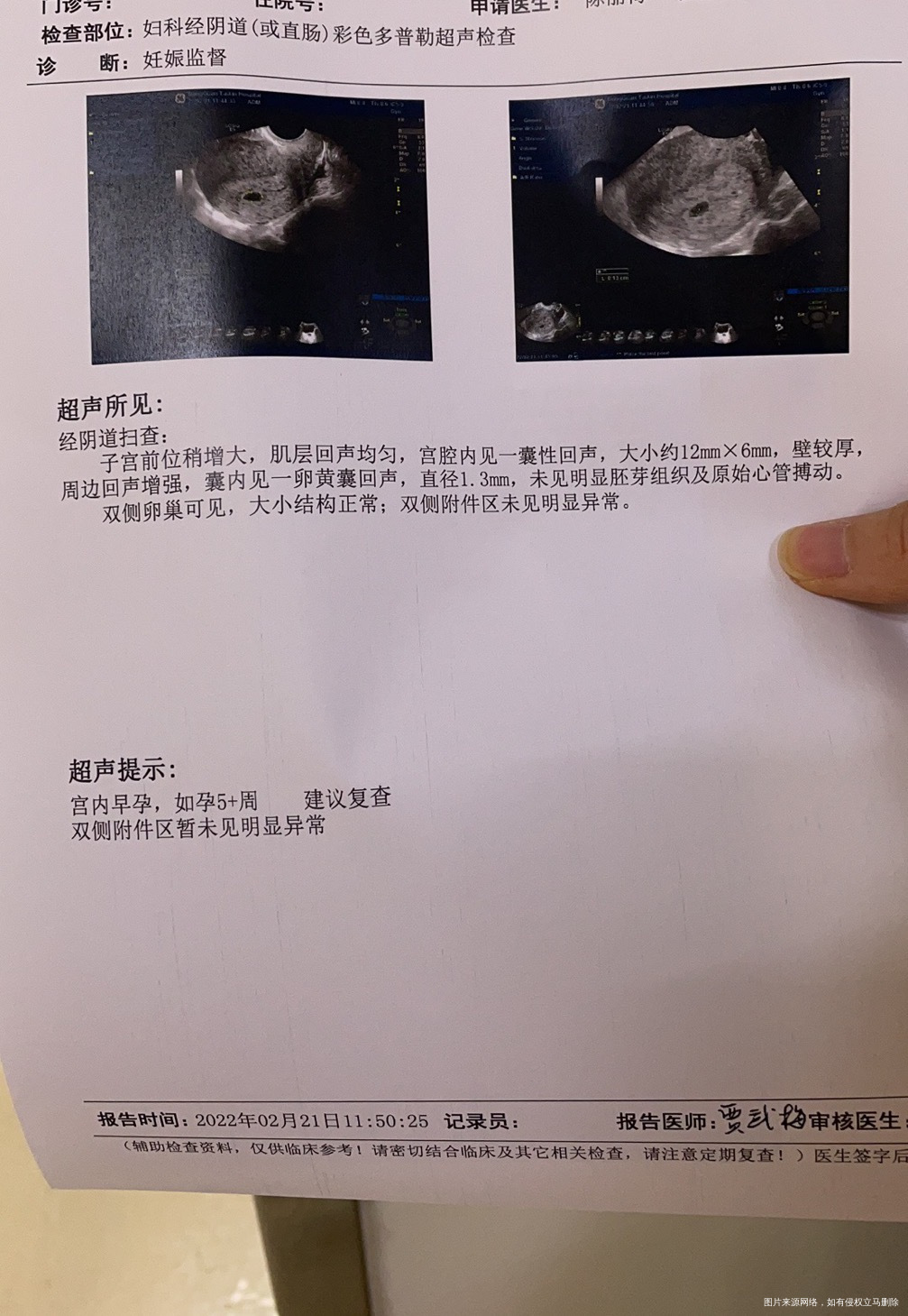 女性30岁2月8号检测出怀孕2月21号阴超显
