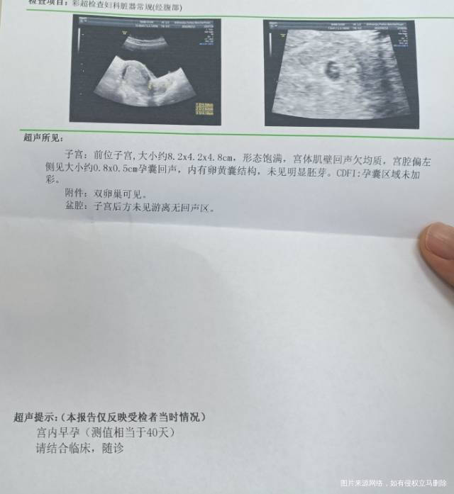 图一是27号那天做的检查图二和图三今天做的能