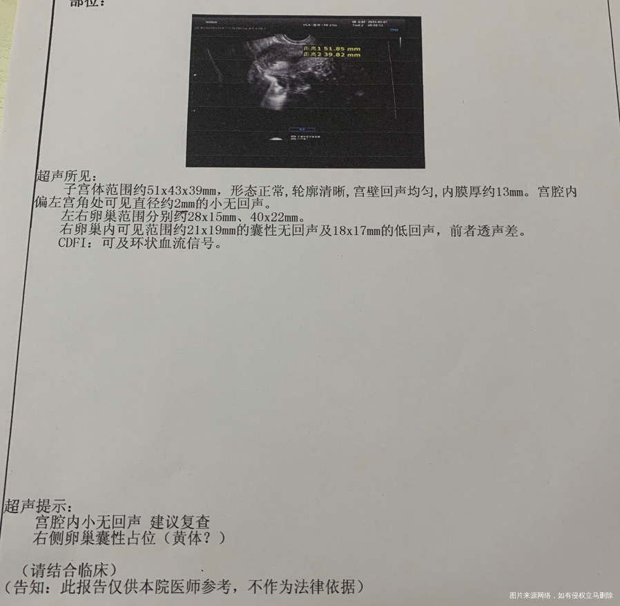 自身有多囊输卵管是通而不畅10月做过导丝备了